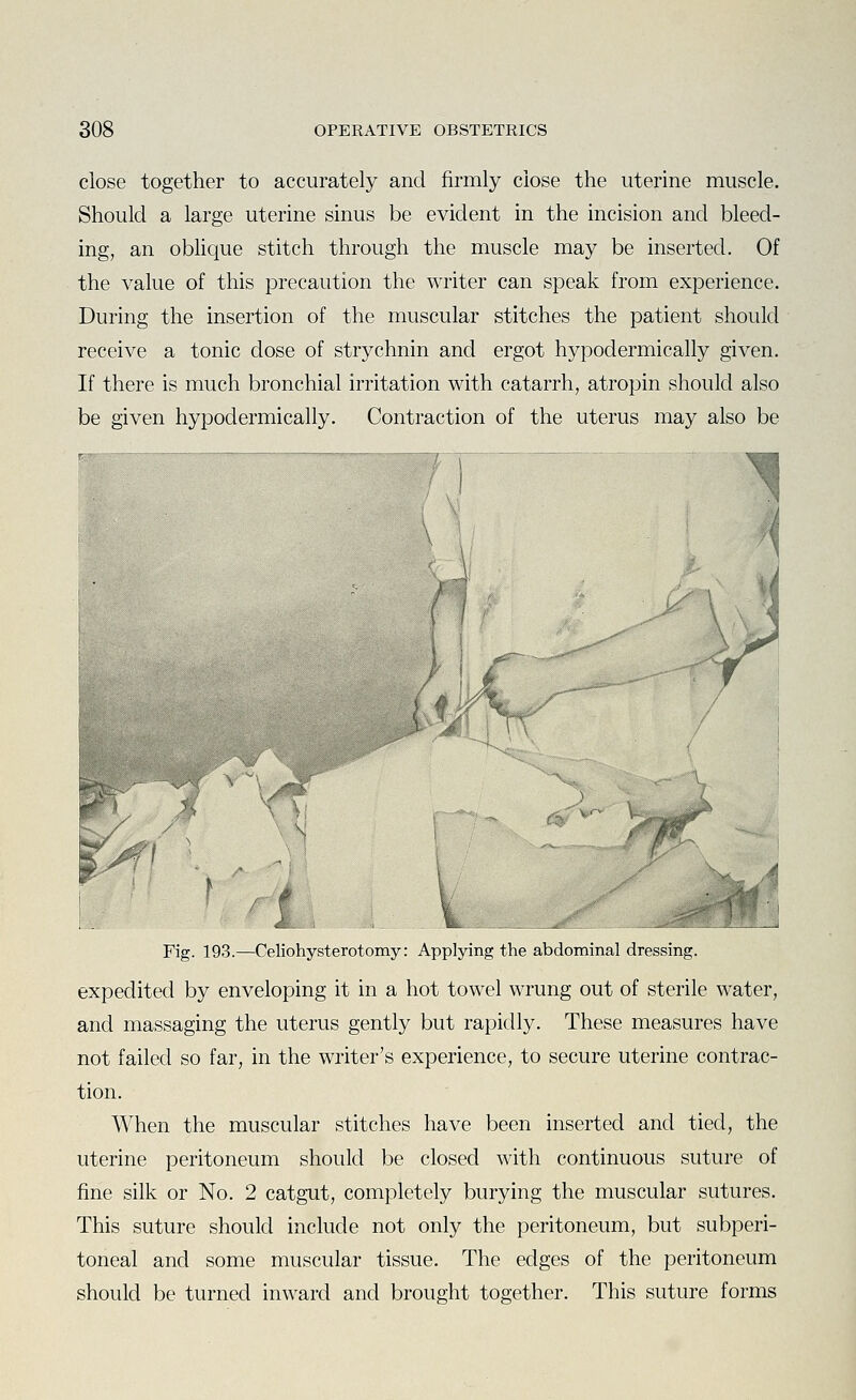 close together to accurately and firmly close the uterine muscle. Should a large uterine sinus be evident in the incision and bleed- ing, an oblique stitch through the muscle may be inserted. Of the value of this precaution the writer can speak from experience. During the insertion of the muscular stitches the patient should receive a tonic dose of strychnin and ergot hypodermically given. If there is much bronchial irritation with catarrh, atropin should also be given hypodermically. Contraction of the uterus may also be Fig. 193.—Celiohysterotomy: Applying the abdominal dressing. expedited by enveloping it in a hot towel wrung out of sterile water, and massaging the uterus gently but rapidly. These measures have not failed so far, in the writer's experience, to secure uterine contrac- tion. When the muscular stitches have been inserted and tied, the uterine peritoneum should be closed with continuous suture of fine silk or No. 2 catgut, completely burying the muscular sutures. This suture should include not only the peritoneum, but subperi- toneal and some muscular tissue. The edges of the peritoneum should be turned inward and brought together. This suture forms