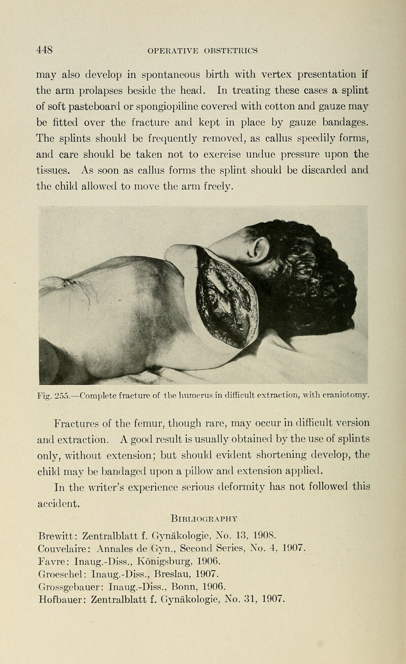 may also develop in spontaneous birth with vertex presentation if the arm prolapses beside the head. In treating these cases a splint of soft pasteboard or spongiopihne covered with cotton and gauze may be fitted over the fracture and kept in place by gauze bandages. The splints should be frequently removed, as callus speedily forms, and care should be taken not to exercise undue pressure upon the tissues. As soon as callus forms the sphnt should be discarded and the child allowed to move the arm freely. Fig. 255.—Complete fracture of the lutmerus in difficult extraction, with craniotomy. Fractures of the femur, though rare, may occur in difficult version and extraction. A good result is usually obtained by the use of splints only, without extension; but should evident shortening develop, the child may be bandaged upon a pillow and extension applied. In the writer's experience serious deformity has not followed this accident. Bibliography Brewitt: Zentralblatt f. Gynakologie, No. 13, 1908. Couvelaire: Annales de Gyn., Second Series, No. 4, 1907. Favre: Inaug.-Diss., Konigsburg, 1906. Groeschel: Inaug.-Diss., Breslau, 1907. Grossgebauer: Inaug.-Diss., Bonn, 1906. Hofbauer: Zentralblatt f. Gynakologie, No. 31, 1907.