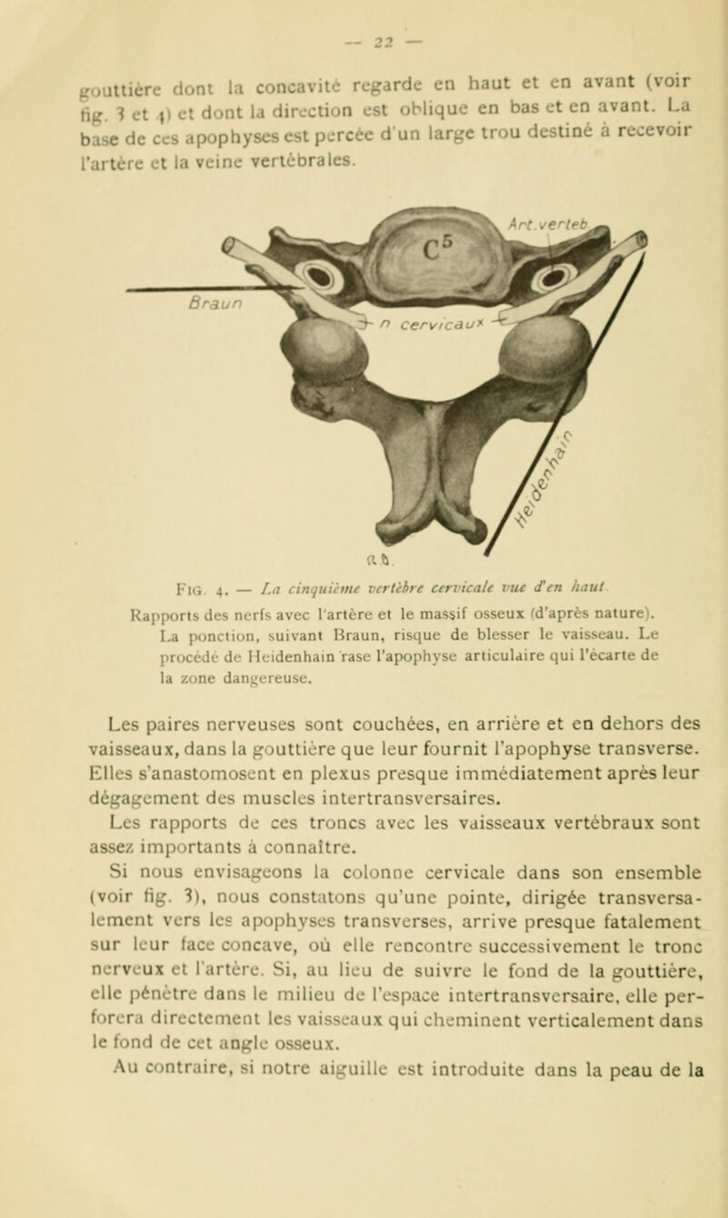 gouttière dont la concavité regarde en haut et en avant (voir fig. 1 et \) et dont la direction est oblique en bas et en avant. La base de ces apophyses est percée dun large trou destiné à recevoir l'artère et la veine vertébrales. Fig 4. — La cinquième vertèbre cervicale viu J'en haut Rapports des nerfs avec l'artère et le massif osseux (d'après nature). La ponction, suivant Braun, risque de blesser le vaisseau. Le procédé de Hcidenhain rase l'apophyse articulaire qui l'écarté de la zone dangereuse. Les paires nerveuses sont couchées, en arrière et en dehors des vaisseaux, dans la gouttière que leur fournit l'apophyse transverse. Elles s'anastomosent en plexus presque immédiatement après leur dégagement des muscles interlransversaires. Les rapports de ces troncs avec les vaisseaux vertébraux sont assez importants à connaître. Si nous envisageons la colonne cervicale dans son ensemble (voir fig. 3), nous constatons qu'une pointe, dirigée transversa- lement vers les apophyses transverses, arrive presque fatalement sur leur face concave, où elle rencontre successivement le tronc nerveux et l'artère. Si, au lieu de suivre le fond de la gouttière, clic pénètre dans le milieu de l'espace intertransvcrsaire. elle per- forera direclemenl les vaisseaux qui cheminent verticalement dans le fond de cet angle osseux. Au contraire, si notre aiguille est introduite dans la peau de la