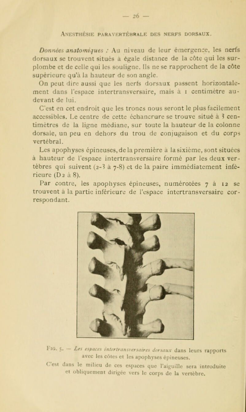 Anf.sthésie paravkrtébrale des nerfs dorsaux. Donuccs anjtomt.jues : Au niveau de leur émergence, les nerfs dorsaux se trouvent situés a égale distance de la côte qui les sur- plombe et de celle qui les souligne. Ils ne se rapprochent de la côte supérieure qu'à la hauteur de son angle. On peut 'Jin: aussi que les nerfs dorsaux passent horizontale- ment dans l'espace intertransversaire, mais à i centimètre au- devant de lui. C'est en cet endroit que les troncs nous seront le plus facilement accessibles. Le centre de cette échancrure se trouve situé à ? cen- timètres de la ligne médiane, sur toute la hauteur de la colonne dorsale, un peu en dehors du trou de coniugaison et du corps vertébral. Les apophyses épineuses, de la première a la sixième, sont situées à hauteur de l'espace intertransversaire formé par les deux ver- tèbres qui suivent (2-3 a 7-8) et de la paire immédiatement infé- rieure (D2 à 8). l'ar contre, les apophyses épineu.ses, numérotées 7 a 12 se trouvent à la partie inférieure de l'espace intertransversaire cor- respondant. lu;. 5. - Lfs fip.icrs intcrtiaimcn.iires Jors.iH.i dans leurs rapports avec les cùics et les a[>ophyses épineuses. C'est dans le milieu de ces espaces que l'aiguille sera introduite et obliquement dirigée vers le corps de la vertèbre.