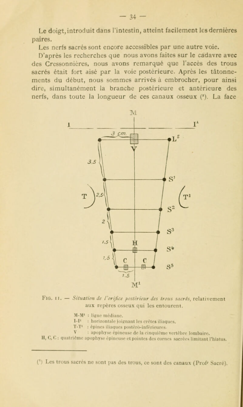 Le doigt, introduit dans l'intestin, atteint facilement les dernières paires. Les nerfs sacrés sont encore accessibles par une autre voie. D'après les recherches que nous avons faites sur le cadavre avec des Cressonnicres, nous avons remarqué que l'accès des trous sacrés était fort aisé par la voie postérieure. Après les tâtonne- ments du début, nous sommes arrivés à embrocher, pour ainsi dire, simultanément la branche postérieure et antérieure des nerfs, dans toute la longueur de ces canaux osseux ('). La face FiG. II. — Situation de l'orijice postérieur des trous sucrés, relativement aux repères osseux qui les entourent. M-M' : Hbiic mc^dinne. I-I' : hori/.onlalojiiiennnt 1rs rivlos iliaques. T-1' : /piiu-s iliaques ptisléro-juréiioures V : apophyse épineuse do la eiiKjuiéme verlébn^ lombairt*. H, r.. r. : quatrième apophyse épineuse et pointes des cornes sacrées limitant l'hiatus. (') Les trous sacrés ne sont pas des trous, ce sont des canaux (Prof» Sacré).