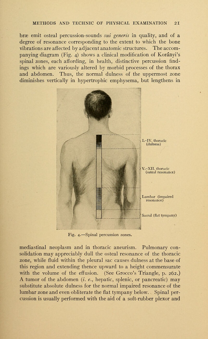 brae emit osteal percussion-sounds sui generis in quality, and of a degree of resonance corresponding to the extent to which the bone vibrations are affected by adjacent anatomic structures. The accom- panying diagram (Fig. 4) shows a clinical modification of Koranyi's spinal zones, each affording, in health, distinctive percussion find- ings which are variously altered by morbid processes of the thorax and abdomen. Thus, the normal dulness of the uppermost zone diminishes vertically in hypertrophic emphysema, but lengthens in I.—IV. thoracic (dulness) i V.-XII. thoracic (osteal resonance) l Lumbar (impaired resonance) C Sacral (flat tympany) Fig. 4.—Spinal percussion zones. mediastinal neoplasm and in thoracic aneurism. Pulmonary con- solidation may appreciably dull the osteal resonance of the thoracic zone, while fluid within the pleural sac causes dulness at the base of this region and extending thence upward to a height commensurate with the volume of the effusion. (See Grocco's Triangle, p. 262.) A tumor of the abdomen (i. e., hepatic, splenic, or pancreatic) may substitute absolute dulness for the normal impaired resonance of the lumbar zone and even obliterate the flat tympany below. Spinal per- cussion is usually performed with the aid of a soft-rubber plexor and