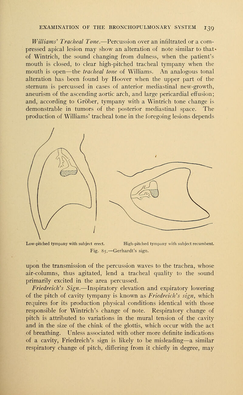 Williams' Tracheal Tone.—Percussion over an infiltrated or a com- pressed apical lesion may show an alteration of note similar to that* of Wintrich, the sound changing from dulness, when the patient's mouth is closed, to clear high-pitched tracheal tympany when the mouth is open—the tracheal tone of Williams. An analogous tonal alteration has been found by Hoover when the upper part of the sternum is percussed in cases of anterior mediastinal new-growth, aneurism of the ascending aortic arch, and large pericardial effusion; and, according to Grober, tympany with a Wintrich tone change is demonstrable in tumors of the posterior mediastinal space. The production of Williams' tracheal tone in the foregoing lesions depends Low-pitched tympany with subject erect. High-pitched tympany with subject recumbent. Fig. 85.—Gerhardt's sign. upon the transmission of the percussion waves to the trachea, whose air-columns, thus agitated, lend a tracheal quality to the sound primarily excited in the area percussed. Friedreich's Sign.—Inspiratory elevation and expiratory lowering of the pitch of cavity tympany is known as Friedreich'''s sign, which requires for its production physical conditions identical with those responsible for Wintrich's change of note. Respiratory change of pitch is attributed to variations in the mural tension of the cavity and in the size of the chink of the glottis, which occur with the act of breathing. Unless associated with other more definite indications of a cavity, Friedreich's sign is likely to be misleading—a similar respiratory change of pitch, differing from it chiefly in degree, may