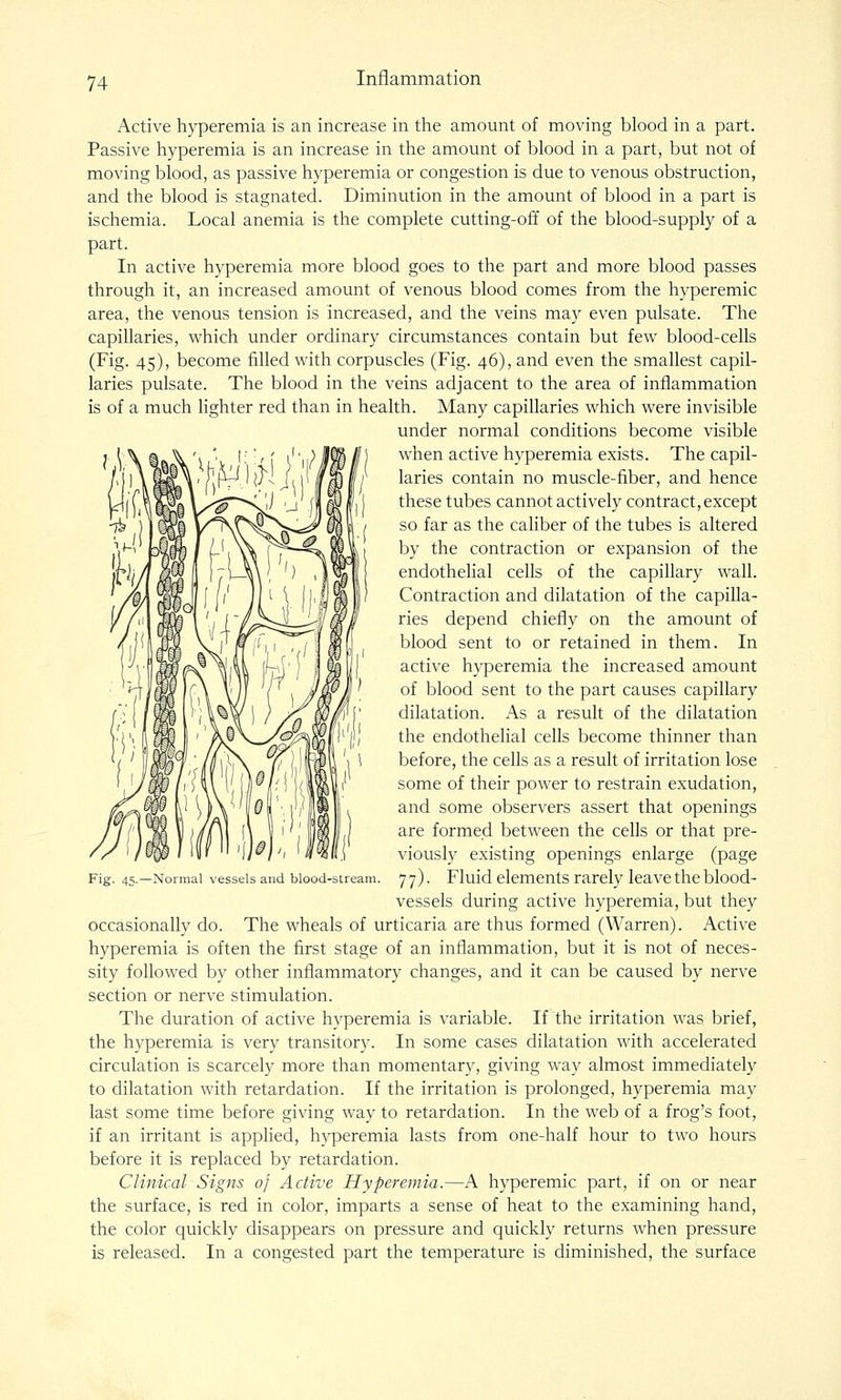 Active hyperemia is an increase in the amount of moving blood in a part. Passive hyperemia is an increase in the amount of blood in a part, but not of moving blood, as passive hyperemia or congestion is due to venous obstruction, and the blood is stagnated. Diminution in the amount of blood in a part is ischemia. Local anemia is the complete cutting-off of the blood-supply of a part. In active hyperemia more blood goes to the part and more blood passes through it, an increased amount of venous blood comes from the hyperemic area, the venous tension is increased, and the veins may even pulsate. The capillaries, which under ordinary circumstances contain but few blood-cells (Fig. 45), become filled with corpuscles (Fig. 46), and even the smallest capil- laries pulsate. The blood in the veins adjacent to the area of inflammation is of a much lighter red than in health. Many capillaries which were invisible under normal conditions become visible when active hyperemia exists. The capil- laries contain no muscle-fiber, and hence these tubes cannot actively contract, except so far as the caHber of the tubes is altered by the contraction or expansion of the endothelial cells of the capillary wall. Contraction and dilatation of the capilla- ries depend chiefly on the amount of blood sent to or retained in them. In active hyperemia the increased amount of blood sent to the part causes capillary dilatation. As a result of the dilatation the endothehal cells become thinner than before, the cells as a result of irritation lose some of their power to restrain exudation, and some observers assert that openings are formed between the cells or that pre- viously existing openings enlarge (page 77). Fluid elements rarely leave the blood- vessels during active hyperemia, but they occasionally do. The wheals of urticaria are thus formed (Warren). Active hyperemia is often the first stage of an inflammation, but it is not of neces- sity followed by other inflammatory changes, and it can be caused by nerve section or nerve stimulation. The duration of active hyperemia is variable. If the irritation was brief, the hyperemia is very transitory. In some cases dilatation with accelerated circulation is scarcely more than momentary, giving way almost immediately to dilatation with retardation. If the irritation is prolonged, hyperemia may last some time before giving way to retardation. In the web of a frog's foot, if an irritant is applied, hyperemia lasts from one-half hour to two hours before it is replaced by retardation. Clinical Signs of Active Hyperemia.—A hyperemic part, if on or near the surface, is red in color, imparts a sense of heat to the examining hand, the color quickly disappears on pressure and quickly returns when pressure is released. In a congested part the temperature is diminished, the surface Fig. 45.—Normal vessels and blood-stream.