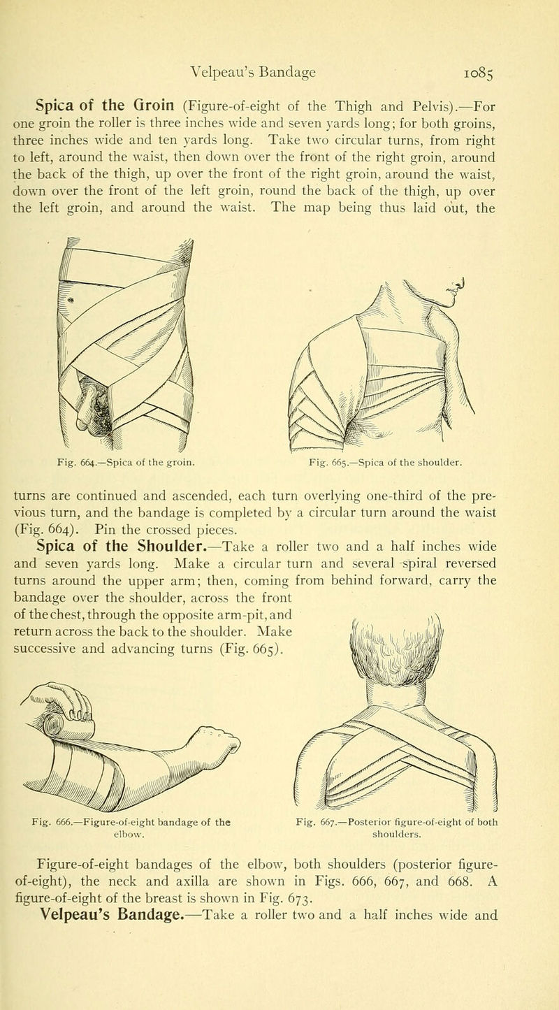 Spica of the Groin (Figure-of-eight of the Thigh and Pelvis).—For one groin the roller is three inches wide and seven yards long; for both groins, three inches wide and ten yards long. Take two circular turns, from right to left, around the waist, then down over the front of the right groin, around the back of the thigh, up over the front of the right groin, around the waist, down over the front of the left groin, round the back of the thigh, up over the left groin, and around the waist. The map being thus laid out, the Fig. 664.—Spica of the groin. Fig. 665.—Spica of the shoulder. turns are continued and ascended, each turn overlying one-third of the pre- vious turn, and the bandage is completed by a circular turn around the waist (Fig. 664). Pin the crossed pieces. Spica of the Shoulder.—Take a roller two and a half inches wide and seven yards long. Make a circular turn and several spiral reversed turns around the upper arm; then, coming from behind forward, carry the bandage over the shoulder, across the front of the chest, through the opposite arm-pit, and ^^ return across the back to the shoulder. Make Iri J successive and advancing turns (Fig. 665). Mwi Fig. 666.—Figure-of-eight bandage of the elbow. Fig. 667.—Posterior figure-of-eight of both shoulders. Figure-of-eight bandages of the elbow, both shoulders (posterior figure- of-eight), the neck and axilla are shown in Figs. 666, 667, and 668. A figure-of-eight of the breast is shown in Fig. 673. Velpeau's Bandage.—Take a roller two and a half inches wide and
