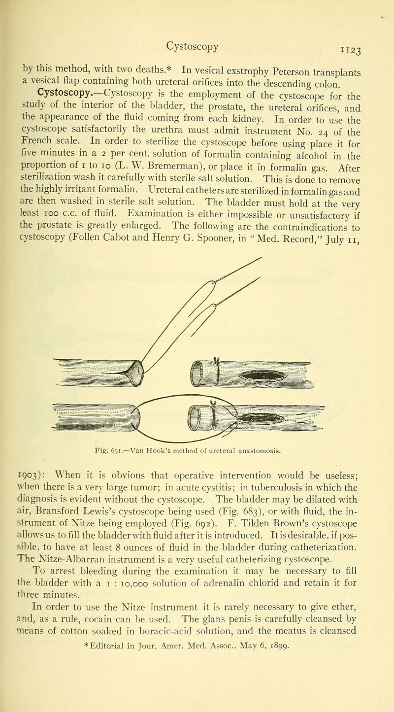 Cystoscopy by this method, with two deaths * In vesical exstrophy Peterson transplants a vesical flap containing both ureteral orifices into the descending colon. Cystoscopy.—Cystoscopy is the employment of the cystoscope for the study of the interior of the bladder, the prostate, the ureteral orifices, and the appearance of the fluid coming from each kidney. In order to use the cystoscope satisfactorily the urethra must admit instrument No. 24 of the French scale. In order to sterilize the cystoscope before using place it for five minutes in a 2 per cent, solution of formalin containing alcohol in the proportion of i to 10 (L. W. Bremerman), or place it in formalin gas. After sterilization wash it carefully with sterile salt solution. This is done to remove the highly irritant formalin. Ureteral catheters are sterilized in formalin gas and are then washed in sterile salt solution. The bladder must hold at the very least 100 c.c. of fluid. Examination is either impossible or unsatisfactory if the prostate is greatly enlarged. The following are the contraindications to cystoscopy (Follen Cabot and Henry G. Spooner, in Med. Record, July 11, Fig. 691.—Van Hook's method of ureteral anastomosis. 1903): When it is obvious that operative intervention would be useless; when there is a very large tumor; in acute cystitis; in tuberculosis in which the diagnosis is evident without the cystoscope. The bladder may be dilated with air, Bransford Lewis's cystoscope being used (Fig. 683), or with fluid, the in- strument of Nitze being employed (Fig. 692). F. Tilden Brown's cystoscope allows us to fill the bladder with fluid after it is introduced. It is desirable, if pos- sible, to have at least 8 ounces of fluid in the bladder during catheterization. The Nitze-Albarran instrument is a very useful catheterizing cystoscope. To arrest bleeding during the examination it may be necessary to fill the bladder with a i : 10,000 solution of adrenalin chlorid and retain it for three minutes. In order to use the Nitze instrument it is rarely necessary to give ether, and, as a rule, cocain can be used. The glans penis is carefully cleansed by means of cotton soaked in boracic-acid solution, and the meatus is cleansed * Editorial in Jour. Amer. Med. Assoc, May 6, 1899.