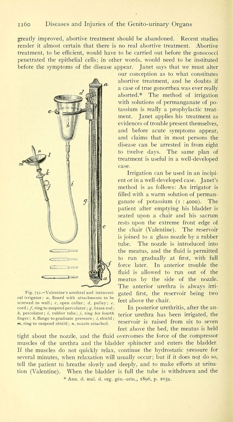 greatly improved, abortive treatment should be abandoned. Recent studies render it almost certain that there is no real abortive treatment. Abortive treatment, to be efficient, would have to be carried out before the gonococci penetrated the epithelial cells; in other words, would need to be instituted before the symptoms of the disease appear. Janet says that we must alter our conception as to what constitutes abortive treatment, and he doubts if a case of true gonorrhea was ever really aborted.* The method of irrigation with solutions of permanganate of po- tassium is really a prophylactic treat- ment. Janet apphes his treatment as evidences of trouble present themselves, and before acute symptoms appear, and claims that in most persons the disease can be arrested in from eight to twelve days. The same plan of treatment is useful in a well-developed case. Irrigation can be used in an incipi- ent or in a well-developed case. Janet's method is as follows: An irrigator is tilled with a warm solution of perman- ganate of potassium (i : 4000). The patient after emptying his bladder is seated upon a chair and his sacrum rests upon the extreme front edge of the chair (Valentine). The reservoir is joined to a glass nozzle by a rubber tube. The nozzle is introduced into the meatus, and the fluid is permitted to run gradually at first, with full force later. In anterior trouble the fluid is allowed to run out of the meatus by the side of the nozzle. The anterior urethra is always irri- gated first, the reservoir being two feet above the chair. In posterior urethritis, after the an- Fig. 712.—Valentine's urethral and intravesi- cal irrigator: a, Board with attachments to be screwed to wall; c, open collar; d, pulley; ^, cord ; f, ring to suspend percolator ; _§-, brass rod ; h, percolator; z, rubber tube; >, ring for fourth ^gj-j^j. urethra has been irrigated, the finger; ^, flange to graduate pressure; /, shield; . . • j r • v. w, ring to suspend shield ; «, nozzle attached. reservOir IS raised irom SIX tO SeVCn feet above the bed, the meatus is held tight about the nozzle, and the fluid overcomes the force of the compressor muscles of the urethra and the bladder sphincter and enters the bladder. If the muscles do not quickly relax, continue the hydrostatic pressure for several minutes, when relaxation will usually occur; but if it does not do so, tell the patient to breathe slowly and deeply, and to make efforts at urina- tion (Valentine). When the bladder is full the tube is withdrawn and the * Ann. d. mal. d. org. gen.-urin., 1896, p. 1031.