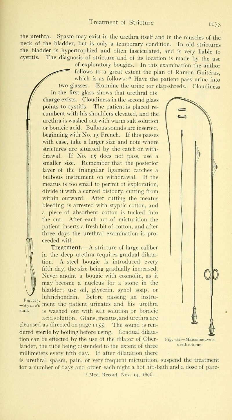 Treatment of Stricture 1173 the urethra. Spasm may exist in the urethra itself and in the muscles of the neck of the bladder, but is only a temporary condition. In old strictures the bladder is hypertrophied and often fasciculated, and is very liable to cystitis. The diagnosis of stricture and of its location is made by the use of exploratory bougies. In this examination the author follows to a great extent the plan of Ramon Guiteras, which is as follows: * Have the patient pass urine into two glasses. Examine the urine for clap-shreds. Cloudiness in the first glass shows that urethral dis- charge exists. Cloudiness in the second glass points to cystitis. The patient is placed re- cumbent with his shoulders elevated, and the urethra is washed out with warm salt solution or boracic acid. Bulbous sounds are inserted, beginning with No. 15 French. If this passes with ease, take a larger size and note where strictures are situated by the catch on with- drawal. If No. 15 does not pass, use a smaller size. Remember that the posterior layer of the triangular ligament catches a bulbous instrument on withdrawal. If the meatus is too small to permit of exploration, divide it with a curved bistoury, cutting from within outward. After cutting the meatus bleeding is arrested with styptic cotton, and a piece of absorbent cotton is tucked into the cut. After each act of micturition the patient inserts a fresh bit of cotton, and after three days the urethral examination is pro- ceeded with. Treatment.—A stricture of large caliber in the deep urethra requires gradual dilata- tion. A steel bougie is introduced every fifth day, the size being gradually increased. Never anoint a bougie with cosmolin, as it may become a nucleus for a stone in the bladder; use oil, glycerin, synol soap, or lubrichondrin. Before passing an instru- —Syme's ment the patient urinates and his urethra staff. is washed out with salt solution or boracic acid solution. Glans, meatus, and urethra are cleansed as directed on page 1155. The sound is ren- dered sterile by boiling before using. Gradual dilata- tion can be effected by the use of the dilator of Ober- lander, the tube being distended to the extent of three millimeters every fifth day. If after dilatation there is urethral spasm, pain, or very frequent micturition, suspend the treatment for a number of days and order each night a hot hip-bath and a dose of pare- * Med. Record, Nov. 14, 1896. Fig. 724.—Maisonneuve's urethrotome.