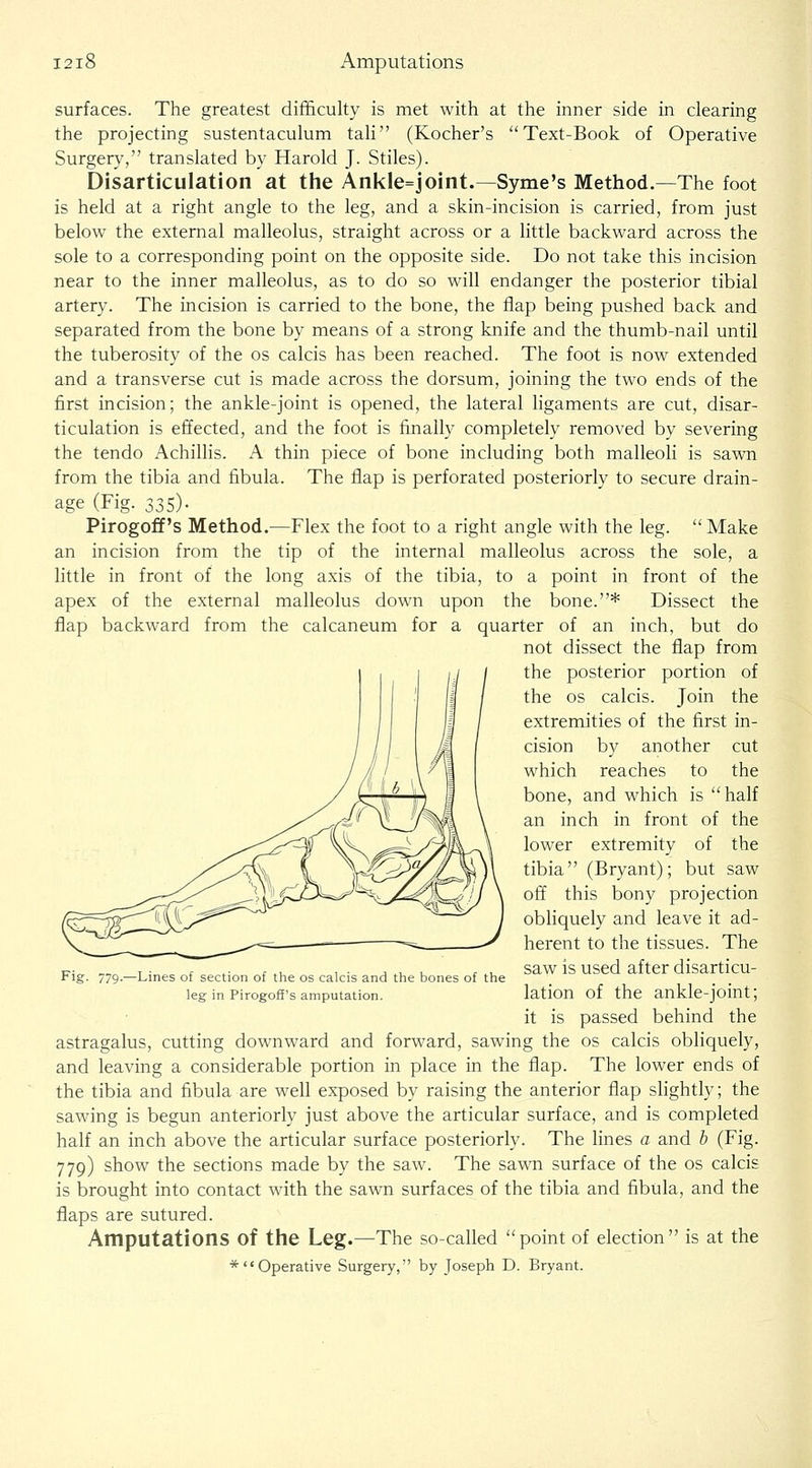 surfaces. The greatest difi&culty is met with at the inner side in clearing the projecting sustentaculum tali (Kocher's Text-Book of Operative Surgery, translated by Harold J. Stiles). Disarticulation at tlie Anl<le=joint.—Syme's Method.—The foot is held at a right angle to the leg, and a skin-incision is carried, from just below the external malleolus, straight across or a little backward across the sole to a corresponding point on the opposite side. Do not take this incision near to the inner malleolus, as to do so will endanger the posterior tibial artery. The incision is carried to the bone, the flap being pushed back and separated from the bone by means of a strong knife and the thumb-nail until the tuberosity of the os calcis has been reached. The foot is now extended and a transverse cut is made across the dorsum, joining the two ends of the first incision; the ankle-joint is opened, the lateral ligaments are cut, disar- ticulation is effected, and the foot is finally completely removed by severing the tendo Achillis. A thin piece of bone including both malleoli is sawn from the tibia and fibula. The flap is perforated posteriorly to secure drain- age (Fig. 335). Pirogoff's Method.—Flex the foot to a right angle with the leg. Make an incision from the tip of the internal malleolus across the sole, a little in front of the long axis of the tibia, to a point in front of the apex of the external malleolus down upon the bone.* Dissect the flap backward from the calcaneum for a quarter of an inch, but do not dissect the flap from the posterior portion of the OS calcis. Join the extremities of the first in- cision by another cut which reaches to the bone, and which is half an inch in front of the lower extremity of the tibia (Bryant); but saw off this bony projection obliquely and leave it ad- herent to the tissues. The saw is used after disarticu- lation of the ankle-joint; it is passed behind the astragalus, cutting downward and forward, sawing the os calcis obliquely, and leaving a considerable portion in place in the flap. The lower ends of the tibia and fibula are well exposed by raising the anterior flap slightly; the sawing is begun anteriorly just above the articular surface, and is completed half an inch above the articular surface posteriorly. The lines a and h (Fig. 779) show the sections made by the saw. The sawn surface of the os calcis is brought into contact with the sawn surfaces of the tibia and fibula, and the flaps are sutured. Amputations of the Leg.—The so-called point of election is at the *Operative Surgery, by Joseph D. Bryant. Fig. 779-—Lines of section of the os calcis and tiie bones of the leg in Pirogofi's amputation.