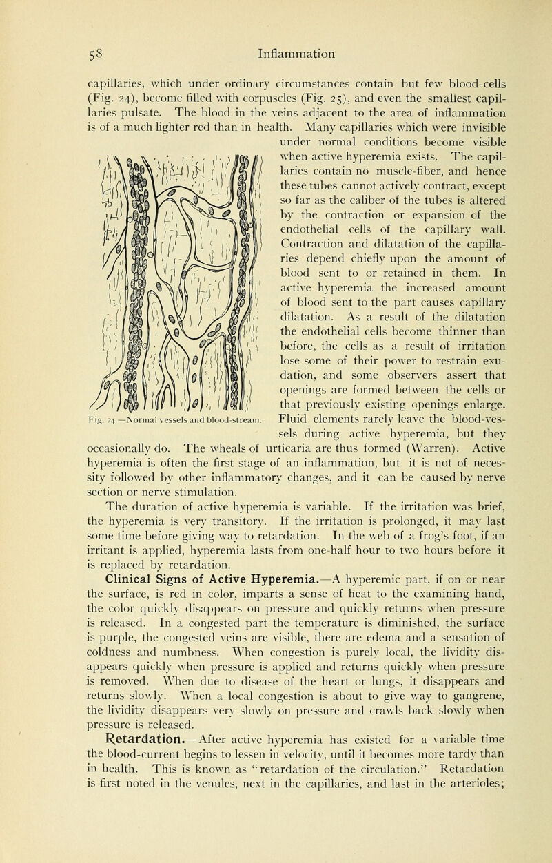 Normal vessels and blood-stream. capillaries, which under ordinary circumstances contain but few blood-cells (Fig. 24), become filled with corpuscles (Fig. 25), and even the smallest capil- laries pulsate. The blood in the veins adjacent to the area of inflammation is of a much lighter red than in health. Many capillaries which were invisible under normal conditions become visible when active hyperemia exists. The capil- laries contain no muscle-fiber, and hence these tubes cannot actively contract, except so far as the caliber of the tubes is altered by the contraction or expansion of the endothelial cells of the capillary wall. Contraction and dilatation of the capilla- ries depend chiefly upon the amount of blood sent to or retained in them. In active hyperemia the increased amount of blood sent to the part causes capillary dilatation. As a result of the dilatation the endothelial cells become thinner than before, the cells as a result of irritation lose some of their power to restrain exu- dation, and some observers assert that openings are formed between the cells or that previously existing openings enlarge. Fluid elements rarely leave the blood-ves- sels during active hyperemia, but they occasionally do. The wheals of urticaria are thus formed (Warren). Active hyperemia is often the first stage of an inflammation, but it is not of neces- sity followed by other inflammatory changes, and it can be caused by nerve section or nerve stimulation. The duration of active hyperemia is variable. If the irritation was brief, the hyperemia is very transitory. If the irritation is prolonged, it may last some time before giving way to retardation. In the web of a frog's foot, if an irritant is applied, hyperemia lasts from one-half hour to two hours before it is replaced by retardation. Clinical Signs of Active Hyperemia.—A hyperemic part, if on or near the surface, is red in color, imparts a sense of heat to the examining hand, the color quickly disappears on pressure and quickly returns when pressure is released. In a congested part the temperature is diminished, the surface is purple, the congested veins are visible, there are edema and a sensation of coldness and numbness. When congestion is purely local, the lividity dis- appears quickly when pressure is applied and returns quickly when pressure is removed. When due to disease of the heart or lungs, it disappears and returns slowly. When a local congestion is about to give way to gangrene, the lividity disappears very slowly on pressure and crawls back slowly when pressure is released. Retardation.—After active hyperemia has existed for a variable time the blood-current begins to lessen in velocity, until it becomes more tardy than in health. This is known as retardation of the circulation. Retardation is first noted in the venules, next in the capillaries, and last in the arterioles;