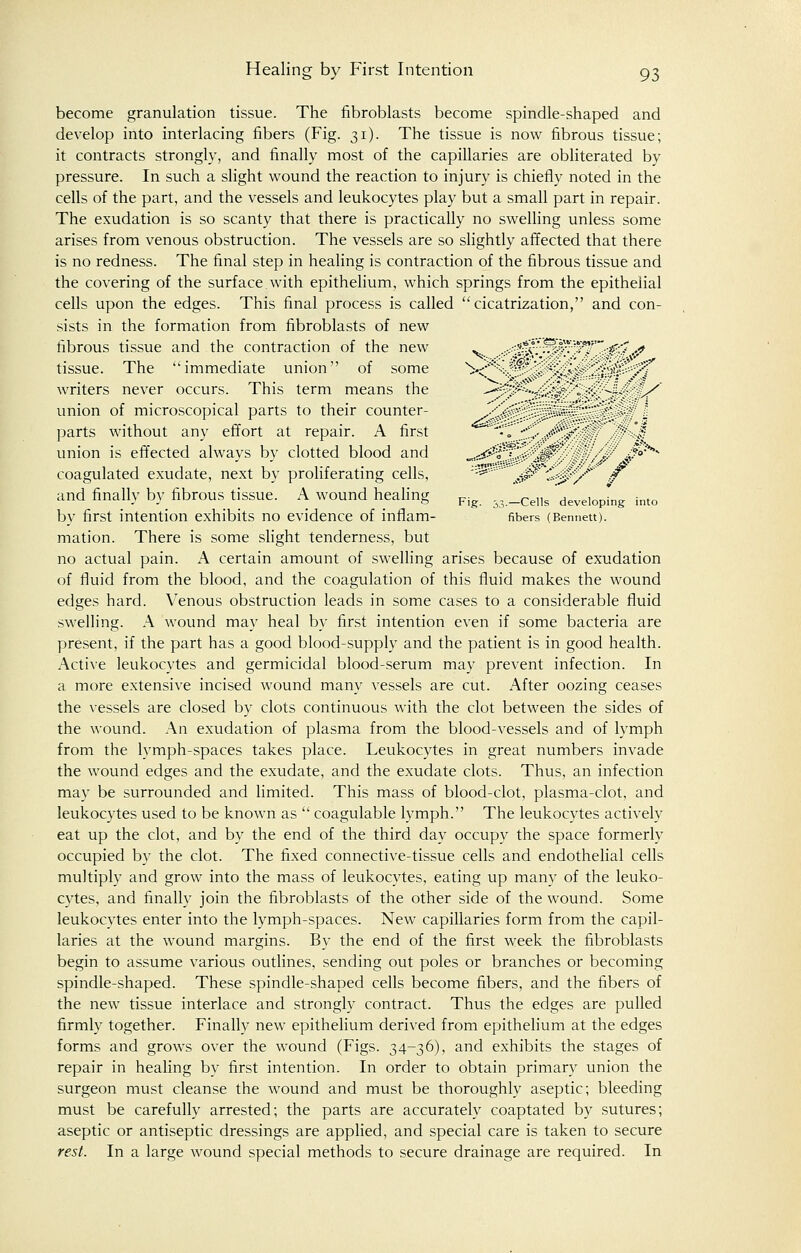 become granulation tissue. The fibroblasts become spindle-shaped and develop into interlacing fibers (Fig. 31). The tissue is now fibrous tissue; it contracts strongly, and finally most of the capillaries are obliterated by pressure. In such a slight wound the reaction to injury is chiefly noted in the cells of the part, and the vessels and leukocytes play but a small part in repair. The exudation is so scanty that there is practically no swelling unless some arises from venous obstruction. The vessels are so slightly affected that there is no redness. The final step in healing is contraction of the fibrous tissue and the covering of the surf ace. with epithelium, which springs from the epithelial cells upon the edges. This final process is called cicatrization, and con- sists in the formation from fibroblasts of new hbrous tissue and the contraction of the new ^ ^V.'.T.'-!''.''' £■''..? tissue. The immediate union of some ^<;':' '-*'. -.-.•'.,.'..•••''' writers never occurs. This term means the ^- ;''•■-.. \--'\ - -—. / union of microscopical parts to their counter- parts without any effort at repair. A first  • „ ■-, ,..■••'. f/ union is effected always by clotted blood and .-jr-'J*^'. .,-?' '<. S°:'* coagulated exudate, next by proliferating cells, ^ ..-,**' J y  £ and finally by fibrous tissue. A wound healing Fig . ,._Cells 'deveioping into by first intention exhibits no evidence of inflam- fibers (Bennett), mation. There is some slight tenderness, but no actual pain. A certain amount of swelling arises because of exudation of fluid from the blood, and the coagulation of this fluid makes the wound edges hard. Venous obstruction leads in some cases to a considerable fluid swelling. A wound may heal by first intention even if some bacteria are present, if the part has a good blood-supply and the patient is in good health. Active leukocytes and germicidal blood-serum may prevent infection. In a more extensive incised wound many vessels are cut. After oozing ceases the vessels are closed by clots continuous with the clot between the sides of the wound. An exudation of plasma from the blood-vessels and of lymph from the lymph-spaces takes place. Leukocytes in great numbers invade the wound edges and the exudate, and the exudate clots. Thus, an infection may be surrounded and limited. This mass of blood-clot, plasma-clot, and leukocytes used to be known as  coagulable lymph. The leukocytes actively eat up the clot, and by the end of the third day occupy the space formerly occupied by the clot. The fixed connective-tissue cells and endothelial cells multiply and grow into the mass of leukocytes, eating up many of the leuko- cytes, and finally join the fibroblasts of the other side of the wound. Some leukocytes enter into the lymph-spaces. New capillaries form from the capil- laries at the wound margins. By the end of the first week the fibroblasts begin to assume various outlines, sending out poles or branches or becoming spindle-shaped. These spindle-shaped cells become fibers, and the fibers of the new tissue interlace and strongly contract. Thus the edges are pulled firmly together. Finally new epithelium derived from epithelium at the edges forms and growrs over the wound (Figs. 34-36), and exhibits the stages of repair in healing by first intention. In order to obtain primary union the surgeon must cleanse the wound and must be thoroughly aseptic; bleeding must be carefully arrested; the parts are accurately coaptated by sutures; aseptic or antiseptic dressings are applied, and special care is taken to secure rest. In a large wound special methods to secure drainage are required. In