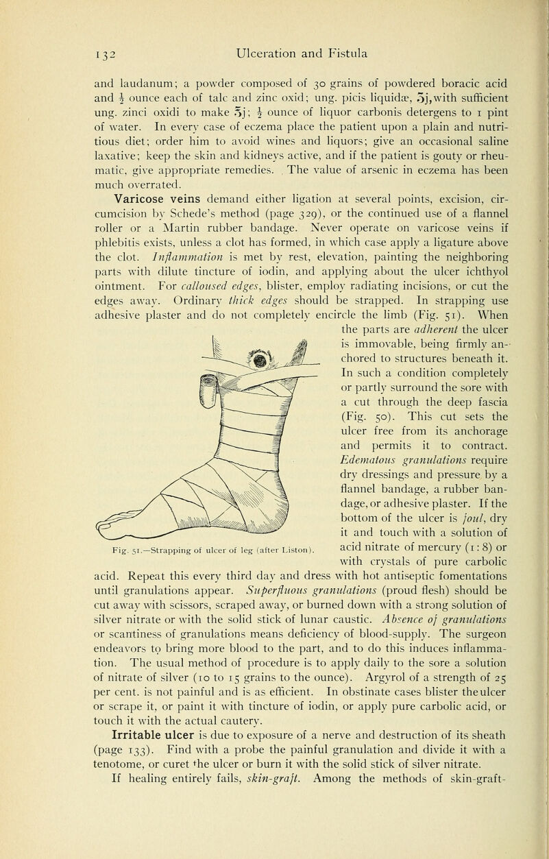 and laudanum; a powder composed of 30 grains of powdered boracic acid and h ounce each of talc and zinc oxid; ung. picis liquidae, 5j,with sufficient ung. zinci oxidi to make Sj; \ ounce of liquor carbonis detergens to 1 pint of water. In every case of eczema place the patient upon a plain and nutri- tious diet; order him to avoid wines and liquors; give an occasional saline laxative; keep the skin and kidneys active, and if the patient is gouty or rheu- matic, give appropriate remedies. , The value of arsenic in eczema has been much overrated. Varicose veins demand either ligation at several points, excision, cir- cumcision by Schede's method (page 329), or the continued use of a flannel roller or a Martin rubber bandage. Never operate on varicose veins if phlebitis exists, unless a clot has formed, in which case apply a ligature above the clot. Inflammation is met by rest, elevation, painting the neighboring parts with dilute tincture of iodin, and applying about the ulcer ichthyol ointment. For calloused edges, blister, employ radiating incisions, or cut the edges away. Ordinary thick edges should be strapped. In strapping use adhesive plaster and do not completely encircle the limb (Fig. 51). When the parts are adherent the ulcer ;[> is immovable, being firmly an- chored to structures beneath it. In such a condition completely or partly surround the sore with a cut through the deep fascia (Fig. 50). This cut sets the ulcer free from its anchorage and permits it to contract. Edematous granulations require dry dressings and pressure by a flannel bandage, a rubber ban- dage, or adhesive plaster. If the bottom of the ulcer is foul, dry it and touch with a solution of acid nitrate of mercury (1:8) or with crystals of pure carbolic acid. Repeat this every third day and dress with hot antiseptic fomentations until granulations appear. Superfluous granulations (proud flesh) should be cut away with scissors, scraped away, or burned down with a strong solution of silver nitrate or with the solid stick of lunar caustic. Absence of granulations or scantiness of granulations means deficiency of blood-supply. The surgeon endeavors to bring more blood to the part, and to do this induces inflamma- tion. The usual method of procedure is to apply daily to the sore a solution of nitrate of silver (10 to 15 grains to the ounce). Argyrol of a strength of 25 per cent, is not painful and is as efficient. In obstinate cases blister the ulcer or scrape it, or paint it with tincture of iodin, or apply pure carbolic acid, or touch it with the actual cautery. Irritable ulcer is due to exposure of a nerve and destruction of its sheath (page 133). Find with a probe the painful granulation and divide it with a tenotome, or curet die ulcer or burn it with the solid stick of silver nitrate. If healing entirely fails, skin-graft. Among the methods of skin-graft- Fig. 51.—Strapping of ulcer of leg (after Liston).