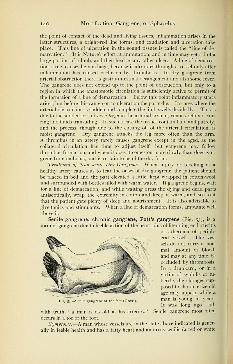 the point of contact of the dead and living tissues, inflammation arises in the latter structures, a bright-red line forms, and exudation and ulceration take place. This line of ulceration in the sound tissues is called the  line of de- marcation. It is Nature's effort at amputation, and in time may get rid of a large portion of a limb, and then heal as any other ulcer. A line of demarca- tion rarely causes hemorrhage, because it ulcerates through a vessel only after inflammation has caused occlusion by thrombosis. In dry gangrene from arterial obstruction there is gastro-intestinal derangement and also some fever. The gangrene does not extend up to the point of obstruction, but only to a region in which the anastomotic circulation is sufficiently active to permit of the formation of a line of demarcation. Below this point inflammatory stasis arises, but before this can go on to ulceration the parts die. In cases where the arterial obstruction is sudden and complete the limb swells decidedly. This is due to the sudden loss of vis a tergo in the arterial system, venous reflux occur- ring and fluids transuding. In such a case the tissues contain fluid and putrefy, and the process, though due to the cutting off of the arterial circulation, is moist gangrene. Dry gangrene attacks the leg more often than the arm. A thrombus in an artery rarely causes gangrene except in the aged, as the collateral circulation has time to adjust itself; but gangrene may follow thrombus formation, and when it does it comes on more slowly than does gan- grene from embolus, and is certain to be of the dry form. Treatment oj Non-senile Dry Gangrene.—When injury or blocking of a healthy artery causes us to fear the onset of dry gangrene, the patient should be placed in bed and the part elevated a little, kept wrapped in cotton-wool and surrounded with bottles filled with warm water. If gangrene begins, wait for a line of demarcation, and while waiting dress the dying and dead parts antiseptically, wrap the extremity in cotton and keep it warm, and see to it that the patient gets plenty of sleep and nourishment. It is also advisable to give tonics and stimulants. When a line of demarcation forms, amputate well above it. Senile gangrene, chronic gangrene, Pott's gangrene (Fig. 53), is a form of gangrene due to feeble action of the heart plus obliterating endarteritis or atheroma of periph- eral vessels. The ves- sels do not carry a nor- mal amount of blood, and may at any time be occluded by thrombosis. In a drunkard, or in a victim of syphilis or tu- bercle, the changes sup- posed to characterize old age may appear while a FigT^T-Senile gangrene of the feet (Gross). lan is young in years. It was long ago said, with truth,  a man is as old as his arteries. Senile gangrene most often occurs in a toe or the foot. Symptoms.—A man whose vessels are in the state above indicated is gener- ally in feeble health and has a fatty heart and an arcus senilis (a red or white