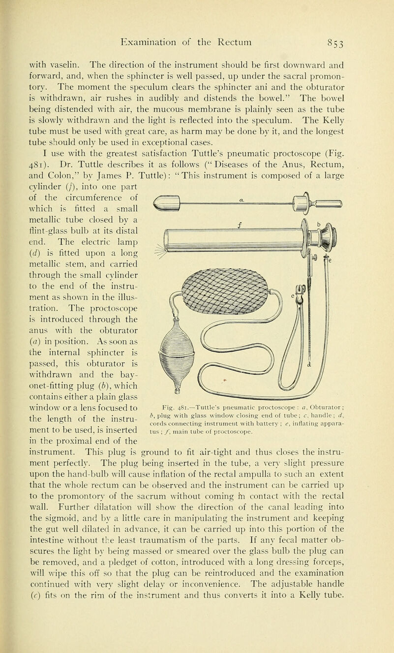 353 with vaselin. The direction of the instrument should be first downward and forward, and, when the sphincter is well passed, up under the sacral promon- tory. The moment the speculum clears the sphincter ani and the obturator is withdrawn, air rushes in audibly and distends the bowel. The bowel being distended with air, the mucous membrane is plainly seen as the tube is slowly withdrawn and the light is reflected into the speculum. The Kelly tube must be used with great care, as harm may be done by it, and the longest tube should only be used in exceptional cases. I use with the greatest satisfaction Tuttle's pneumatic proctoscope (Fig. 481). Dr. Tuttle describes it as follows (Diseases of the Anus, Rectum, and Colon, by James P. Tuttle): This instrument is composed of a large cylinder (/), into one part of the circumference of which is fitted a small metallic tube closed by a flint-glass bulb at its distal end. The electric lamp (c/) is fitted upon a long metallic stem, and carried through the small cylinder to the end of the instru- ment as shown in the illus- tration. The proctoscope is introduced through the anus with the obturator (a) in position. As soon as the internal sphincter is passed, this obturator is withdrawn and the bay- onet-fitting plug (b), which contains either a plain glass window or a lens focused to the length of the instru- ment to be used, is inserted in the proximal end of the instrument. This plug is ground to fit air-tight and thus closes the instru- ment perfectly. The plug being inserted in the tube, a very slight pressure upon the hand-bulb will cause inflation of the rectal ampulla to such an extent that the whole rectum can be observed and the instrument can be carried up to the promontory of the sacrum without coming m contact with the rectal wall. Further dilatation will show the direction of the canal leading into the sigmoid, and by a little care in manipulating the instrument and keeping the gut well dilated in advance, it can be carried up into this portion of the intestine without the least traumatism of the parts. If any fecal matter ob- scures the light by being massed or smeared over the glass bulb the plug can be removed, and a pledget of cotton, introduced with a long dressing forceps, will wipe this off so that the plug can be reintroduced and the examination continued with very slight delay or inconvenience. The adjustable handle (c) fits on the rim of the instrument and thus converts it into a Kelly tube. Fig. 481.—Tuttle's pneumatic proctoscope: a, Obturator ; b, plug with glass window closing end of tube; c, handle; </,. cords connecting instrument with battery ; e, inflating appara- tus ; f, main tube of proctoscope.