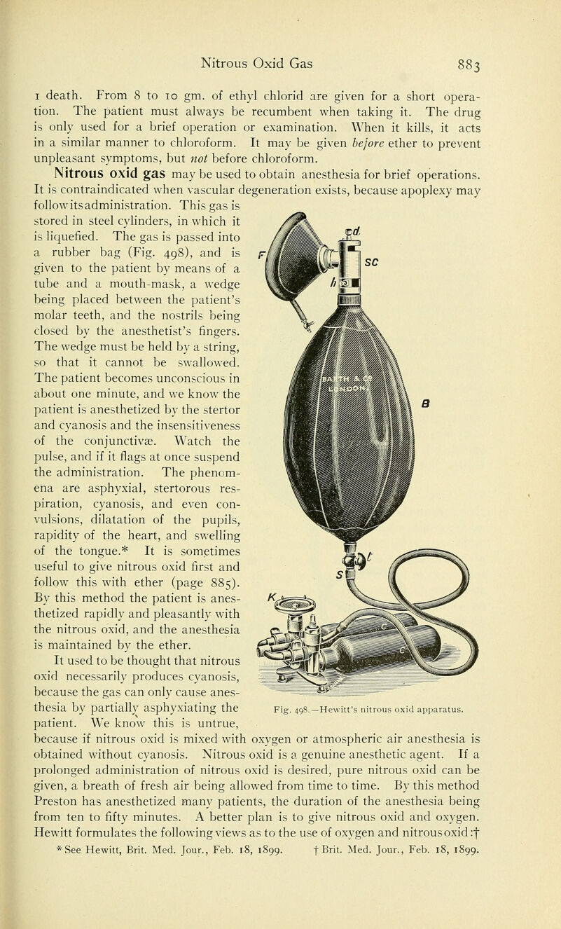 1 death. From 8 to 10 gm. of ethyl chlorid are given for a short opera- tion. The patient must always be recumbent when taking it. The drug is only used for a brief operation or examination. When it kills, it acts in a similar manner to chloroform. It may be given before ether to prevent unpleasant symptoms, but not before chloroform. Nitrous oxid gas may be used to obtain anesthesia for brief operations. It is contraindicated when vascular degeneration exists, because apoplexy may follow its administration. This gas is stored in steel cylinders, in which it is liquefied. The gas is passed into a rubber bag (Fig. 498), and is given to the patient by means of a tube and a mouth-mask, a wedge being placed between the patient's molar teeth, and the nostrils being closed by the anesthetist's fingers. The wedge must be held by a string, so that it cannot be swallowed. The patient becomes unconscious in about one minute, and we know the patient is anesthetized by the stertor and cyanosis and the insensitiveness of the conjunctivae. Watch the pulse, and if it flags at once suspend the administration. The phenom- ena are asphyxial, stertorous res- piration, cyanosis, and even con- vulsions, dilatation of the pupils, rapidity of the heart, and swelling of the tongue.* It is sometimes useful to give nitrous oxid first and follow this with ether (page 885). By this method the patient is anes- thetized rapidly and pleasantly with the nitrous oxid, and the anesthesia is maintained by the ether. It used to be thought that nitrous oxid necessarily produces cyanosis, because the gas can only cause anes- thesia by partially asphyxiating the patient. We know this is untrue, because if nitrous oxid is mixed with oxygen or atmospheric air anesthesia is obtained without cyanosis. Nitrous oxid is a genuine anesthetic agent. If a prolonged administration of nitrous oxid is desired, pure nitrous oxid can be given, a breath of fresh air being allowed from time to time. By this method Preston has anesthetized many patients, the duration of the anesthesia being from ten to fifty minutes. A better plan is to give nitrous oxid and oxygen. Hewitt formulates the following views as to the use of oxygen and nitrous oxid :f *See Hewitt, Brit. Med. Jour., Feb. 18, 1899. f Brit. Med. Jour., Feb. 18, 1899. m Fig. 498.—Hewitt's nitrous oxid apparatus.