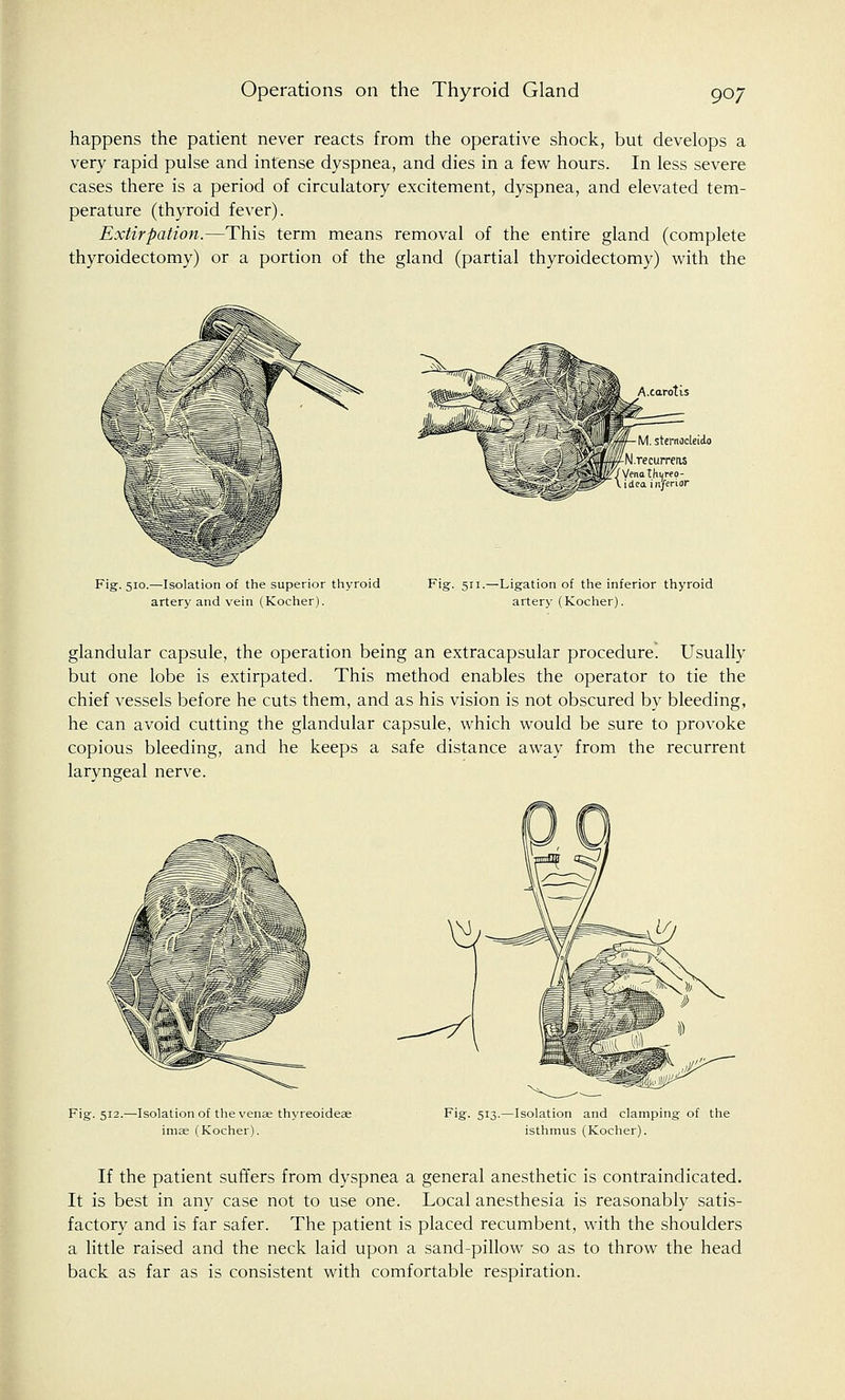 happens the patient never reacts from the operative shock, but develops a very rapid pulse and intense dyspnea, and dies in a few hours. In less severe cases there is a period of circulatory excitement, dyspnea, and elevated tem- perature (thyroid fever). Extirpation.—This term means removal of the entire gland (complete thyroidectomy) or a portion of the gland (partial thyroidectomy) with the A.carotis Fig. 510.—Isolation of the superior thyroid artery and vein (Kocher). Fig. 511.—Ligation of the inferior thyroid artery (Kocher). glandular capsule, the operation being an extracapsular procedure. Usually but one lobe is extirpated. This method enables the operator to tie the chief vessels before he cuts them, and as his vision is not obscured by bleeding, he can avoid cutting the glandular capsule, which would be sure to provoke copious bleeding, and he keeps a safe distance away from the recurrent laryngeal nerve. 'MSB* Vm Fig. 512.—Isolation of the venae thyreoideae imae (Kocher). Fig. 513.—Isolation and clamping of the isthmus (Kocher). If the patient suffers from dyspnea a general anesthetic is contraindicated. It is best in any case not to use one. Local anesthesia is reasonably satis- factory and is far safer. The patient is placed recumbent, with the shoulders a little raised and the neck laid upon a sand-pillow so as to throw the head back as far as is consistent with comfortable respiration.