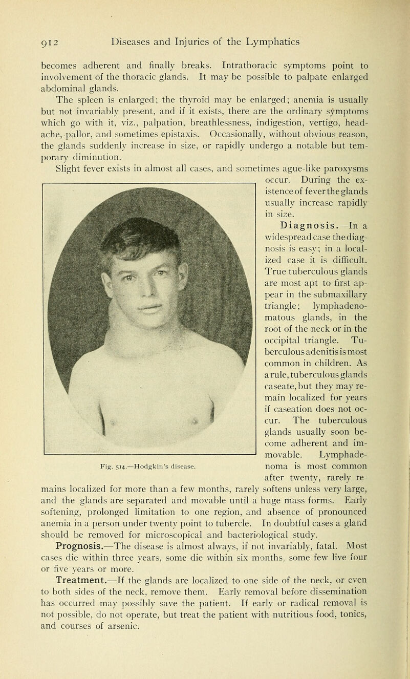 becomes adherent and finally breaks. Intrathoracic symptoms point to involvement of the thoracic glands. It may be possible to palpate enlarged abdominal glands. The spleen is enlarged; the thyroid may be enlarged; anemia is usually but not invariably present, and if it exists, there are the ordinary symptoms which go with it, viz., palpation, breathlessness, indigestion, vertigo, head- ache, pallor, and sometimes epistaxis. Occasionally, without obvious reason, the glands suddenly increase in size, or rapidly undergo a notable but tem- porary diminution. Slight fever exists in almost all cases, and sometimes ague-like paroxysms occur. During the ex- istence of fever the glands usually increase rapidly in size. Diagnosis.—In a widespread case the diag- nosis is easy; in a local- ized case it is difficult. True tuberculous glands are most apt to first ap- pear in the submaxillary triangle; lymphadeno- matous glands, in the root of the neck or in the occipital triangle. Tu- berculous adenitis is most common in children. As a rule, tuberculous glands caseate, but they may re- main localized for years if caseation does not oc- cur. The tuberculous glands usually soon be- come adherent and im- movable. Lymphade- noma is most common after twenty, rarely re- mains localized for more than a few months, rarely softens unless very large, and the glands are separated and movable until a huge mass forms. Early softening, prolonged limitation to one region, and absence of pronounced anemia in a person under twenty point to tubercle. In doubtful cases a gland should be removed for microscopical and bacteriological study. Prognosis.—The disease is almost always, if not invariably, fatal. Most cases die within three years, some die within six months, some few live four or five years or more. Treatment.—If the glands are localized to one side of the neck, or even to both sides of the neck, remove them. Early removal before dissemination has occurred may possibly save the patient. If early or radical removal is not possible, do not operate, but treat the patient with nutritious food, tonics, and courses of arsenic. Fig. 514.—Hodgkin's disease.