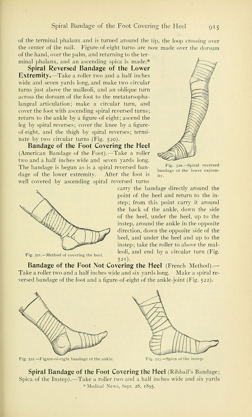 of the terminal phalanx and is turned around the tip, the loop crossing over the center of the nail. Figure-of-eight turns are now made over the dorsum of the hand, over the palm, and returning to the ter- minal phalanx, and an ascending spica is made.* Spiral Reversed Bandage of the Lower Extremity.—Take a roller two and a half inches wide and seven yards long, and make two circular turns just above the malleoli, and an oblique turn across the dorsum of the foot to the metatarsopha- langeal articulation; make a circular turn, and cover the foot with ascending spiral reversed turns; return to the ankle by a figure-of-eight; ascend the leg by spiral reverses; cover the knee by a figure- of-eight, and the thigh by spiral reverses; termi- nate by two circular turns (Fig. 520). Bandage of the Foot Covering the Heel (American Bandage of the Foot).—Take a roller two and a half inches wide and seven yards long. The bandage is begun as is a spiral reversed ban- dage of the lower extremity. After the foot is well covered by ascending spiral reversed turns carry the bandage directly around the point of the heel and return to the in- step; from this point carry it around the back of the ankle, down the side of the heel, under the heel, up to the instep, around the ankle in the opposite direction, down the opposite side of the heel, and under the heel and up to the instep; take the roller to above the mal- leoli, and end by a circular turn (Fig. 52i). Bandage of the Foot Not Covering the Heel (French Method).— Take a roller two and a half inches wide and six yards long. Make a spiral re- versed bandage of the foot and a figure-of-eight of the ankle-joint (Fig. 522). Fig. 520.—Spiral reversed bandage of the lower extrem- ity. Fig. 521.—Method of covering the heel. Fig. 522.—Figure-of-eight bandage of the ankle. Fig. 523.—Spiea of the instep. Spiral Bandage of the Foot Covering the Heel (Ribbail's Bandage; Spica of the Instep).—Take a roller two and a half inches wide and six yards * Medical News, Sept. 28, 1895.
