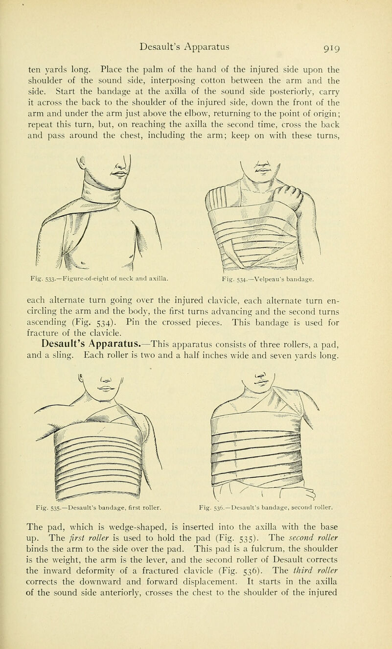 ten yards long. Place the palm of the hand of the injured side upon the shoulder of the sound side, interposing cotton between the arm and the side. Start the bandage at the axilla of the sound side posteriorly, carry it across the back to the shoulder of the injured side, down the front of the arm and under the arm just above the elbow, returning to the point of origin; repeat this turn, but, on reaching the axilla the second time, cross the back and pass around the chest, including the arm; keep on with these turns, Fig. 533.—Figure-of-eight of neck and axilla. Fig. 534.—Velpeau's bandage. each alternate turn going over the injured clavicle, each alternate turn en- circling the arm and the body, the first turns advancing and the second turns ascending (Fig. 534). Pin the crossed pieces. This bandage is used for fracture of the clavicle. Desault's Apparatus.—This apparatus consists of three rollers, a pad, and a sling. Each roller is two and a half inches wide and seven yards long. Fig. 535.—Desault's bandage, first roller. Fig. 536. —Desault's bandage, second roller. The pad, which is wedge-shaped, is inserted into the axilla with the base up. The first roller is used to hold the pad (Fig. 535). The second roller binds the arm to the side over the pad. This pad is a fulcrum, the shoulder is the weight, the arm is the lever, and the second roller of Desault corrects the inward deformity of a fractured clavicle (Fig. 536). The third roller corrects the downward and forward displacement. It starts in the axilla of the sound side anteriorly, crosses the chest to the shoulder of the injured