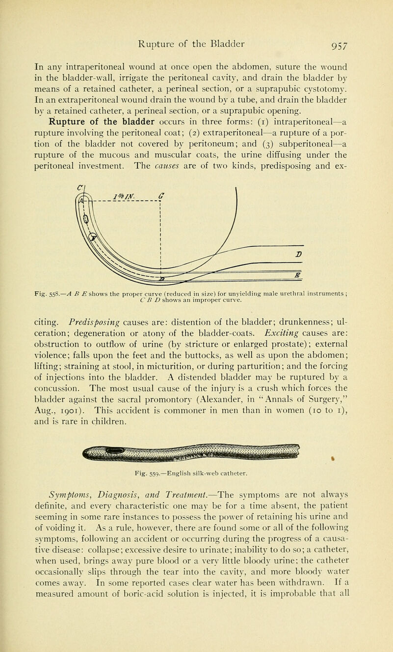 In any intraperitoneal wound at once open the abdomen, suture the wound in the bladder-wall, irrigate the peritoneal cavity, and drain the bladder by means of a retained catheter, a perineal section, or a suprapubic cystotomy. In an extraperitoneal wound drain the wound by a tube, and drain the bladder by a retained catheter, a perineal section, or a suprapubic opening. Rupture of the bladder occurs in three forms: (i) intraperitoneal—a rupture involving the peritoneal coat; (2) extraperitoneal—a rupture of a por- tion of the bladder not covered by peritoneum; and (3) subperitoneal—a rupture of the mucous and muscular coats, the urine diffusing under the peritoneal investment. The causes are of two kinds, predisposing and ex- Fig. 558.—A B E shows the proper curve (reduced in size) for unyielding male urethral instruments ; C B D shows an improper curve. citing. Predisposing causes are: distention of the bladder; drunkenness; ul- ceration; degeneration or atony of the bladder-coats. Exciting causes are: obstruction to outflow of urine (by stricture or enlarged prostate); external violence; falls upon the feet and the buttocks, as well as upon the abdomen; lifting; straining at stool, in micturition, or during parturition; and the forcing of injections into the bladder. A distended bladder may be ruptured by a concussion. The most usual cause of the injury is a crush which forces the bladder against the sacral promontory (Alexander, in ''Annals of Surgery, Aug., 1901). This accident is commoner in men than in women (10 to 1), and is rare in children. Fig. 559.—English silk-web catheter. Symptoms, Diagnosis, and Treatment.—The symptoms are not always definite, and every characteristic one may be for a time absent, the patient seeming in some rare instances to possess the power of retaining his urine and of voiding it. As a rule, however, there are found some or all of the following symptoms, following an accident or occurring during the progress of a causa- tive disease: collapse; excessive desire to urinate; inability to do so; a catheter, when used, brings away pure blood or a very little bloody urine; the catheter occasionally slips through the tear into the cavity, and more bloody water comes away. In some reported cases clear water has been withdrawn. If a measured amount of boric-acid solution is injected, it is improbable that all