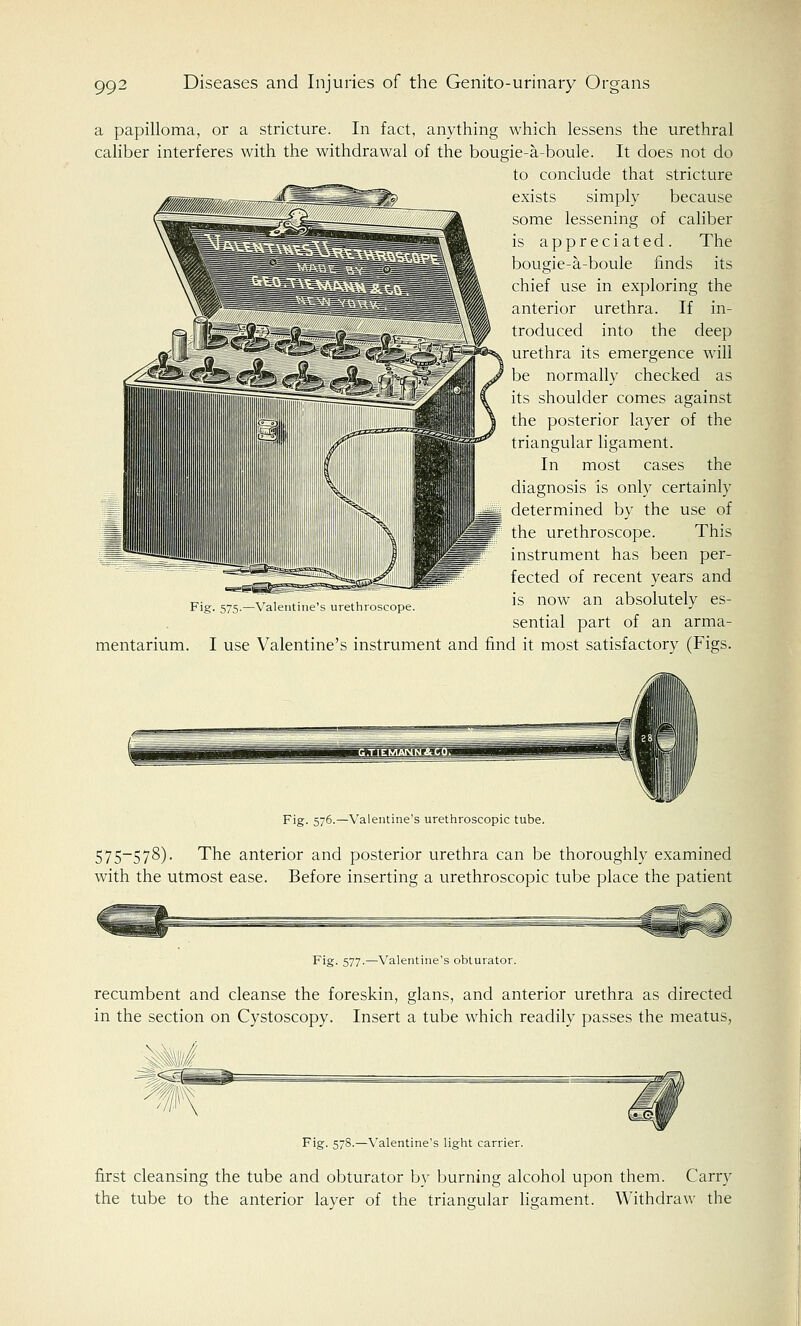 a papilloma, or a stricture. In fact, anything which lessens the urethral caliber interferes with the withdrawal of the bougie-a-boule. It does not do to conclude that stricture exists simply because some lessening of caliber is appreciated. The bougie-a-boule finds its chief use in exploring the anterior urethra. If in- troduced into the deep urethra its emergence will be normally checked as its shoulder comes against the posterior layer of the triangular ligament. In most cases the diagnosis is only certainly ^g determined by the use of the urethroscope. This instrument has been per- fected of recent years and is now an absolutely es- sential part of an arma- mentarium. I use Valentine's instrument and find it most satisfactory (Figs. Fig. 575.—Valentine's urethroscope Fig- 576.—Valentine's urethroscopic tube. 575-578). The anterior and posterior urethra can be thoroughly examined with the utmost ease. Before inserting a urethroscopic tube place the patient Fig. 577.—Valentine's obturator. recumbent and cleanse the foreskin, glans, and anterior urethra as directed in the section on Cystoscopy. Insert a tube which readily passes the meatus, Fig. 578.—Valentine's light carrier. first cleansing the tube and obturator by burning alcohol upon them. Carry the tube to the anterior layer of the triangular ligament. Withdraw the