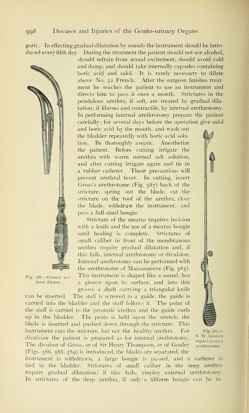 goric. In effecting gradual dilatation by sounds the instrument should be intro- duced every fifth day. During the treatment the patient should not use alcohol, should refrain from sexual excitement, should avoid cold and damp, and should take internally capsules containing boric acid and salol. It is rarely necessary to dilate above No. 32 French. After the surgeon finishes treat- ment he teaches the patient to use an instrument and directs him to pass it once a month. Strictures in the pendulous urethra, if soft, are Treated by gradual dila- tation ; if fibrous and contractile, by internal urethrotomy. In performing internal urethrotomy prepare the patient carefully; for several days before the operation give salol and boric acid by the mouth, and wash out the bladder repeatedly with boric-acid solu- tion. Be thoroughly aseptic. Anesthetize the patient. Before cutting irrigate the urethra with warm normal salt solution, and after cutting irrigate again and tie in a rubber catheter. These precautions will prevent urethral fever. In cutting, insert Gross's urethrotome (Fig. 587) back of the stricture, spring out the blade, cut the stricture on the roof of the urethra, close the blade, withdraw the instrument, and pass a full-sized bougie. Stricture of the meatus requires incision with a knife and the use of a meatus bougie until healing is complete. Strictures of small caliber in front of the membranous urethra require gradual dilatation and, if this fails, internal urethrotomy or divulsion. Internal urethrotomy can be performed with the urethrotome of Maisonneuve (Fig. 585). This instrument is shaped like a sound, has a groove upon its surface, and into this groove a shaft carrying a triangular knife can be inserted. The staff is screwed to a guide, the guide is carried into the bladder and the staff follows it. The point of the staff is carried to the prostatic urethra and the guide curls up in the bladder. The penis is held upon the stretch, the blade is inserted and pushed down through the stricture. This instrument cuts the stricture, but not the healthy urethra. For divulsion the patient is prepared as for internal urethrotomy. The divulsor of Gross, or of Sir Henry Thompson, or of Gouley (Figs. 586, 588, 589) is introduced, the blades are separated, the instrument is withdrawn, a large bougie is passed, and a tied in the bladder. Strictures of small caliber in the deep urethra require gradual dilatation; if this fails, employ external urethrotomy. In strictures of the deep urethra, if only a filiform bougie can be in- Fig. 586.—Gross's ure thral dilator. Fig. 587.— S. W. Gross's exploratory urethrotome. catheter is