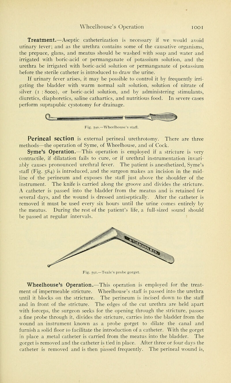 Treatment.—Aseptic catheterization is necessary if we would avoid urinary fever; and as the urethra contains some of the causative organisms, the prepuce, glans, and meatus should be washed with soap and water and irrigated with boric-acid or permanganate of potassium solution, and the urethra be irrigated with boric-acid solution or permanganate of potassium before the sterile catheter is introduced to draw the urine. If urinary fever arises, it may be possible to control it by frequently irri- gating the bladder with warm normal salt solution, solution of nitrate of silver (i : 8000), or boric-acid solution, and by administering stimulants, diuretics, diaphoretics, saline cathartics, and nutritious food. In severe cases perform suprapubic cystotomy for drainage. Fig. 590.—Wheelhouse's staff. Perineal section is external perineal urethrotomy. There are three methods—the operation of Syme, of Wheelhouse, and of Cock. Syme's Operation.—This operation is employed if a stricture is very contractile, if dilatation fails to cure, or if urethral instrumentation invari- ably causes pronounced urethral fever. The patient is anesthetized, Syme's staff (Fig. 584) is introduced, and the surgeon makes an incision in the mid- line of the perineum and exposes the staff just above the shoulder of the instrument. The knife is carried along the groove and divides the stricture. A catheter is passed into the bladder from the meatus and is retained for several days, and the wound is dressed antiseptically. After the catheter is removed it must be used every six hours until the urine comes entirely by the meatus. During the rest of the patient's life, a full-sized sound should be passed at regular intervals. ■ Fig. 591.—Teale's probe gorget. Wheelhouse's Operation.—This operation is employed for the treat- ment of impermeable stricture. Wheelhouse's staff is passed into the urethra until it blocks on the stricture. The perineum is incised down to the staff and in front of the stricture. The edges of the cut urethra are held apart with forceps, the surgeon seeks for trie opening through the stricture, passes a fine probe through it, divides the stricture, carries into the bladder from the wound an instrument known as a probe gorget to dilate the canal and furnish a solid floor to facilitate the introduction of a catheter. With the gorget in place a metal catheter is carried from the meatus into the bladder. The gorget is removed and the catheter is tied in place. After three or four days the catheter is removed and is then passed frequently. The perineal wound is,