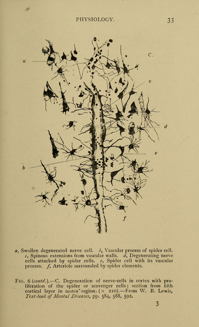 a, Swollen degenerated nerve cell, d, Yascular process of spider cell. c, Spinous extensions from vascular walls, d, Degenerating nerve cells attacked by spider cells. e} Spider cell with its vascular process, f, Arteriole surrounded by spider elements. Fig. 6 (contd.).—C. Degeneration of nerve-cells in cortex with pro- liferation of the spider or scavenger cells; section from fifth cortical layer in motor'* region( ( x 210).—From W. B. Lewis, Text-book of Mental Diseases, pp. 584, 588, 592.