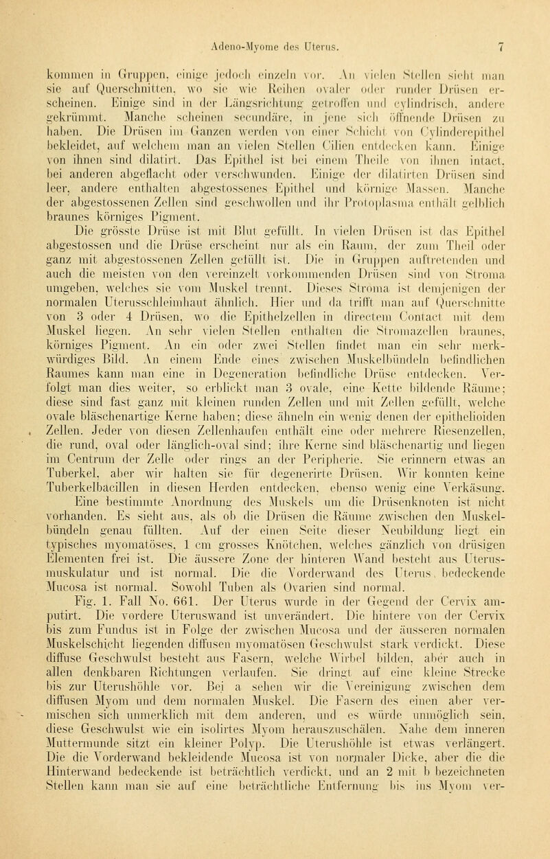kommen in Gruppen, einige jedoch einzeln vor. An vielen Stellen sieh! man sie auf Querschnitten, wo sie wie Reihen ovaler oder runder Drüsen er- scheinen. Einige sind in der Längsrichtung getroffen und cylindrisch, andere gekrümmt. Manche scheinen seeundäre, in jene sich öffnende Drüsen zu haben. Die Drüsen im Ganzen werden von einer Schichj von Cylinderepithel bekleidet, auf welchem man an vielen Stellen CiJien entdecken kann. Einige von ihnen sind dilatirt. Das Epithel ist bei einem Theile von ihnen intact, bei anderen abgeflacht oder verschwunden. Einige der dilatirten Drüsen sind leer, andere enthalten abgestossenes Epithel und körnige Massen. Manche der abgestossenen Zeilen sind geschwollen und ihr Protoplasma enthäli gelblich braunes körniges Pigment. Die grösste Drüse ist mit Blut gefüllt. In vielen Drüsen ist das Epithel abgestossen und die Drüse erscheint nur als ein Raum, der zum Theil oder ganz mit abgestossenen Zellen gelullt ist. Die in Gruppen auftretenden und auch die meisten von den vereinzelt vorkommenden Drüsen sind von Stroma umgeben, welches sie vom Muskel trennt. Dieses Stroma ist demjenigen der normalen Uterusschleimhaut ähnlich. Hier und da trifft man auf Querschnitte von 3 oder 4 Drüsen, wo die Epithelzellen in directem Contact mit dem Muskel liegen. An sehr vielen Stellen enthalten die Stromazellen braunes, körniges Pigment. An ein oder zwei Stellen findet man ein sein- merk- würdiges Bild. An einem Ende eines zwischen Muskelbündeln befindlichen Raumes kann man eine in Degeneration befindliche Drüse entdecken. Ver- folgt man dies weiter, so erblickt man 3 ovale, eine Kette bildende Räume; diese sind fast ganz mit kleinen runden Zellen und mit Zellen gefüllt, welche ovale bläschenartige Kerne haben; diese ähneln ein wenig denen der epithelioiden Zellen. Jeder von diesen Zellenhaufen enthält eine oder mehrere Riesenzellen, die rund, oval oder länglich-oval sind; ihre Kerne sind bläschenartig und liegen im Centrum der Zelle oder rings an der Peripherie. Sie erinnern etwas an Tuberkel, aber wir halten sie für degenerirte Drüsen. Wir konnten keine Tuberkelbacillen in diesen Herden entdecken, ebenso wenig eine Verkäsung. Eine bestimmte Anordnung des Muskels um die Drüsenknoten ist nicht vorhanden. Es sieht aus, als ob die Drüsen die Räume zwischen den Muskel- bündeln genau füllten. Auf der einen Seite dieser Neubildung liegt ein typisches myomatöses, 1 cm grosses Knötchen, welches gänzlich von drüsigen Elementen frei ist. Die äussere Zone der hinteren Wand besteht aus Uterus- muskulatur und ist normal. Die die Vorderwand des Uterus, bedeckende Mucosa ist normal. Sowohl Tuben als Ovarien sind normal. Fig. 1. Fall No. 661. Der Uterus wurde in der Gegend der Cervix am- putirt. Die vordere Uteruswand ist unverändert. Die hintere von der Cervix bis zum Fundus ist in Folge der zwischen Mucosa und der äusseren normalen Muskelschicht liegenden diffusen myomatösen Geschwulst stark verdickt. Diese diffuse Geschwulst besteht aus Fasern, welche Wirbel bilden, aber auch in allen denkbaren Richtungen verlaufen. Sie dringt auf eine kleine Strecke bis zur Uterushöhle vor. Bei a sehen wir die Vereinigung zwischen dem diffusen Myom und dem normalen Muskel. Die Fasern des einen aber ver- mischen sich unmerklich mit dem anderen, und es würde unmöglich sein, diese Geschwulst wie ein isolirtes Myom herauszuschälen. Nahe dem inneren Muttermunde sitzt ein kleiner Polyp. Die Uterushöhle ist etwas verlängert. Die die Vorderwancl bekleidende Mucosa ist von normaler Dicke, aber die die Hinterwand bedeckende ist beträchtlich verdickt, und an 2 mit b bezeichneten Stellen kann man sie auf eine beträchtliche Entfernuna- bis ins Myom ver-