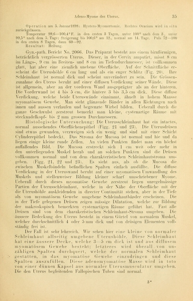 Operation am 5. Januarl898: Hystero-Myomectomie. Hechtes Ovarium wird in situ zurückgelassen. Temperatur 99,6—100,4° F. in den ersten 3 Tagen, unter 100° nach dem 3., m 99,5° nach dem 5. Tage; Steigerung bis 100,6° am 12., aorma] am 14. Tage. Puls 72 — 100 in den ersten 8 Tagen, dann 60—92. Resultat: Heilung. Gyn.-path. Bericht No. 2066. Das Präparal bestehl aus einem birnförmigen, beträchtlich vergrösserten Uterus. Dieser, in der Cervix amputirt, misst -Sein im Längs-, 9 cm im Breiten- und 8 cm im Tiefendurchmesser, isi vollkommen glatt, hat aber eine ziemlich unebene Oberfläche. Auf der Schnittfläche er- scheint die Uterushöhle 6 cm lang und als ein enger Schlitz (Fig. 20). Ihre Schleimhaut ist normal dick und scheint unverändert zu sein. Die Grössen- zu nähme des Uterus beruht auf einer diffusen Verdickung seiner Wände. Diese isi allgemein, aber an der vorderen Wand ausgeprägter als an der hinteren. Die Vorderwand ist 4 bis 5 cm, die hintere 3 bis 3,5 cm dick. Diese diffuse Verdickung, welche beide Uteruswände einnimmt, ähnelt in hohem Maasse niyomatösem Gewebe. Man sieht glänzende Bänder in allen Richtungen nach innen und aussen verlaufen und begrenzte Wirbel bilden. Ueberall durch die ganze Geschwulst zerstreut bemerkt man kleine, cystenartige Räume mit Stecknadelkopf- bis 2 mm grossen Durchmessern. Histologische Untersuchung: Die Uterusschleimhaut hat ein intactes, normal aussehendes Oberflächenepithel (Figg. 21 und 23). Die Uterusdrüsen sind etwas gewunden, verzweigen sich ein wenig und sind mit einer Schicht Cylinderepithel bedeckt. Das Stroma der Mucosa ist normal und hie und da liegen einige kleine runde Zellen. An vielen Punkten findet man ein höchst auffallendes Bild. Die Mucosa erstreckt sich 1 cm weit oder mehr in den unterliegenden Muskel herab und an solchen Punkten sind die Drüsen vollkommen normal und von dem charakteristischen Schleimhautstroma um- geben. (Figg. 21, 22 und 23). Es sieht aus, als ob die Mucosa die zwischen Muskelbündeln befindlichen Spalten einfach ausfüllte. Die diffuse Verdickung in der Uteruswand beruht auf einer myomatösen Umwandlung des Muskels und stellenweiser Bildung kleiner scharf umschriebener Myome. Ueberall durch dieses myomatöse Gewebe zerstreut liegen unregelmässige Partien der Uterusschleimhaut, welche in der Nähe der Oberfläche mit der die Uterushöh]e auskleidenden in directer Continuität stehen, aber in der Tiefe als von niyomatösem Gewebe umgebene Schleimhautbänder erscheinen. Die in der Tiefe gelegenen Drüsen zeigen massige Dilatation. Welche zur Bildung der makroskopisch bemerkten cystenartigen Räume geführt hat. Fast alle Drüsen sind von dem charakeristischen Schleimhaut-Stroma umgeben. Die äussere Bedeckung des Uterus besteht in einem Gürtel von normalem Muskel, welcher durchschnittlich 4 oder 5 mm dick und von drüsigen Elementen voll- ständig frei ist. Der Fall ist sehr lehrreich. Wir sehen hier eine kleine von normaler Schleimhaut allseitig umgebene Uterushöhle. Diese Schleimhaut hat eine äussere Decke, welche 3—5 cm dick ist und ans diffusem myomätösem Gewebe besteht: letzteres wird überall von un- zähligen Spalten durchquert, welche der normalen Schleimhaut gestatten, in das myomatöse Gewebe einzudringen und diese Spalten auszufüllen. Diese adenomyomatöse Masse wird in toto von einer dünnen Kapsel aus normaler Uterusmusculatiir umgeben. Die den Uterus begleitenden Fallopischen Tuben sind normal.