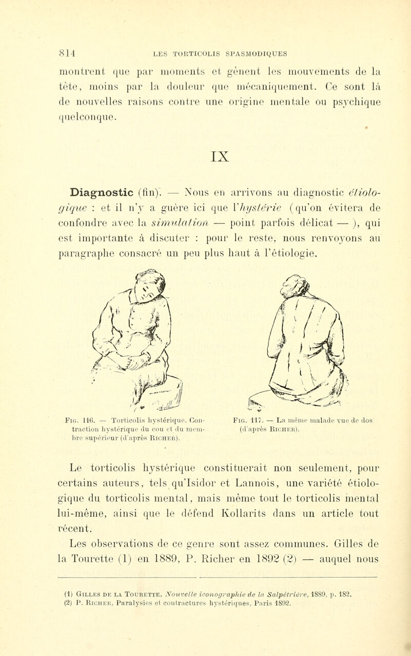 montrent que par moments et gênent les mouvements de la tète, moins par la douleur que mécaniquement. Ce sont là de nouvelles raisons contre une origine mentale ou psychique quelconque. IX Diagnostic (finy. — Nous en arrivons au diagnostic éliolo- gique : et il n'y a guère ici que Y hystérie (qu'on évitera de confondre avec la simulation — point parfois délicat — ), qui est importante à discuter : pour le reste, nous renvoyons au paragraphe consacré un peu plus haut à l'étiologie. FiG. 116. — Torticolis hystérique. Con- traction hystérique du cou et du mem- bre supérieur (d'aiirès Rioher). FiG. 117. — La même malade vue de dos (d'après Richer). Le torticolis hystérique constituerait non seulement, pour certains auteurs, tels qu'lsidor et Lannois, une variété étiolo- gique du torticolis mental, mais même tout le torticolis mental lui-même, ainsi que le défend Kollarits dans un article tout récent. Les observations de ce genre sont assez communes. Gilles de la Tourette (1) en 1889, P. Richer en 1892 (2) — auquel nous (1) Gilles de la Tourette, Nouvelle iconographie de la Salpélriére, 1889. p. 182. (2) P. Richer. Paralysies et contractures hystériques. Paris 1892.