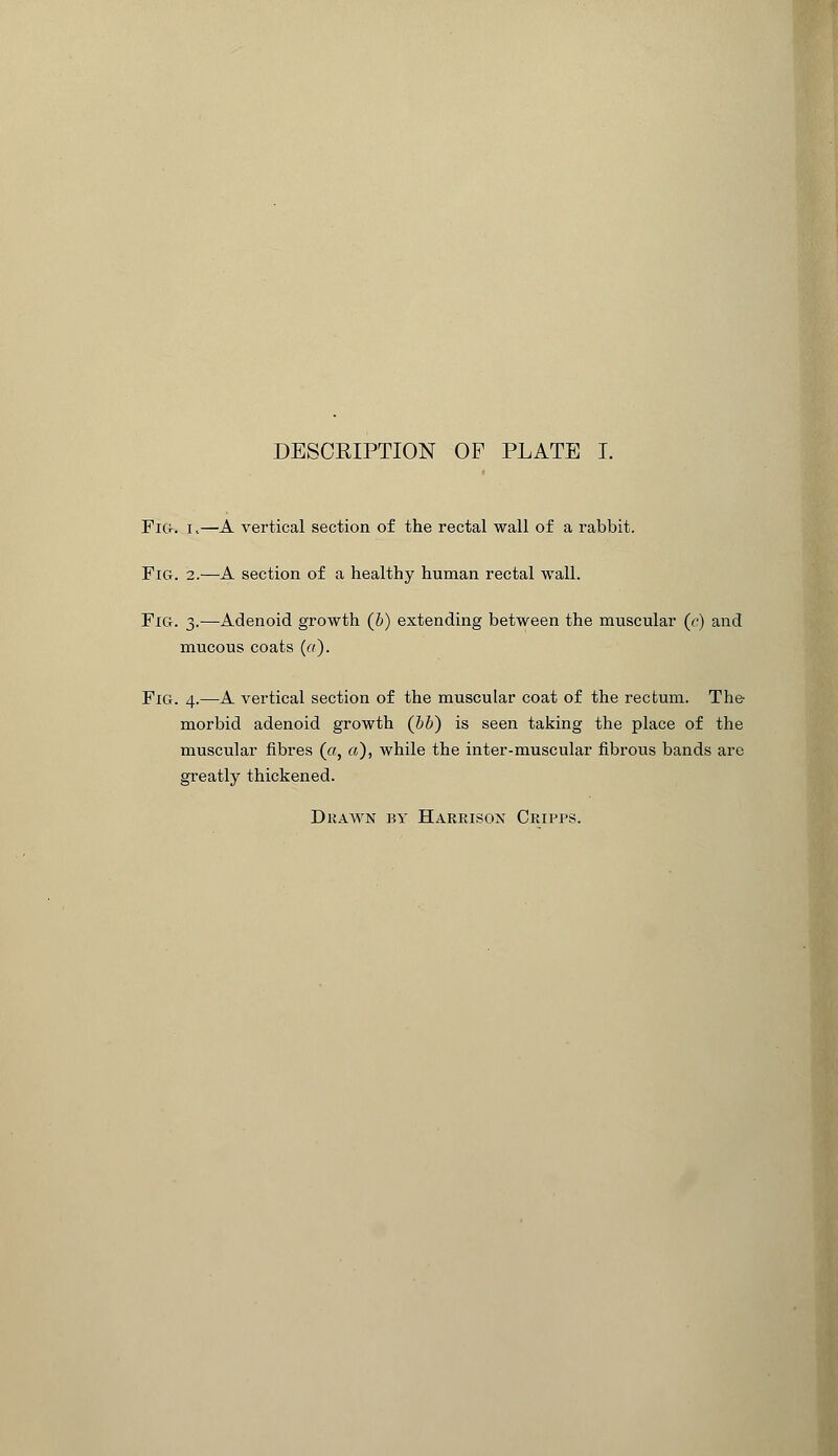 Fig. i,—A vertical section of the rectal wall of a rabbit. Fig. 2.—A section of a healthy human rectal wall. Fig. 3.—Adenoid growth (&) extending between the muscular (c) and mucous coats (a). Fig. 4.—A vertical section of the muscular coat of the rectum. The- morbid adenoid growth (bb) is seen taking the place of the muscular fibres (a, a), while the inter-muscular fibrous bands are greatly thickened.