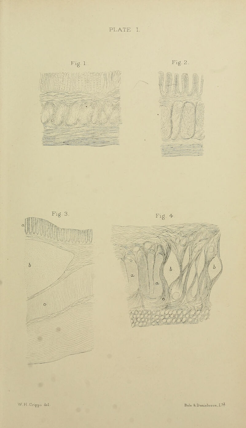 Fid. 1. Fid. 2. Fid. 3. Fl£5. 4 :f/||l'ii|