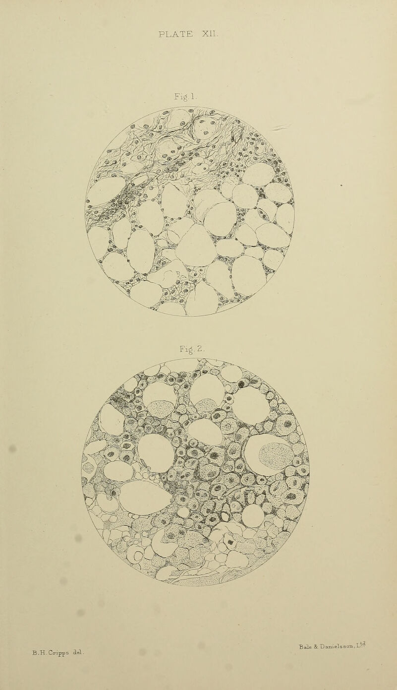 Fifi.l Fid. 2 7V Ml B.H.Crrpps Ael. Bale & Darnel5so-n.L^
