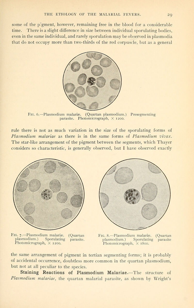 some of the pigment, however, remaining free in the blood for a considerable time. There is a slight difference in size between individual sporulating bodies, even in the same individual, and rarely sporulation may be observed in plasmodia that do not occupy more than two-thirds of the red corpuscle, but as a general Fig. 6.—Plasmodium malarias. (Quartan plasmodium.) Presegmenting parasite. Photomicrograph, X 1200. rule there is not as much variation in the size of the sporulating forms of Plasmodium malariae as there is in the same forms of Plasmodium vivax. The star-like arrangement of the pigment between the segments, which Thayer considers so characteristic, is generally observed, but I have observed exactly Fig. 7.—Plasmodium malarias. (Quartan Plasmodium.) Sporulating parasite. Photomicrograph, X 1200. Fig. 8.—Plasmodium malarias. (Quartan Plasmodium.) Sporulating parasite Photomicrograph, X 1800. the same arrangement of pigment in tertian segmenting forms; it is probably of accidental occurrence, doubtless more common in the quartan plasmodium, but not at all peculiar to the species. Staining Reactions of Plasmodium Malariae.—The structure of PlasmodiuMi malariae, the quartan malarial parasite, as shown by Wright's