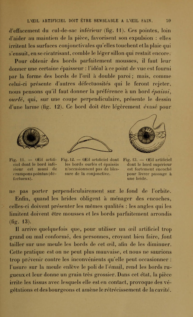 d'effacement du cul-de-sac inférieur (fîg. 11). Ces pointes, loin d'aider au maintien de la pièce, favorisent son expulsion : elles irritent les surfaces conjonctivales qu'elles touchent et la plaie qui s'ensuit, en se cicatrisant, comble le léger sillon qui restait encore. Pour obtenir des bonis parfaitement mousses, il faut leur donner une certaine épaisseur : l'idéal à ce point de vue <ist fourni par la forme des bords de l'œil à double paroi ; mais, comme celui-ci présente d'autres défectuosités qui le feront rejeter, nous pensons qu'il faut donner la préférence à un bord épaissi, ourlé, qui, sur une coupe perpendiculaire, présente le dessin d'une larme (fîg. \2). Ce bord doit être légèrement évasé pour j£ï± Fi#- 11. — Œil artifi- Fig. 12. — Œil artificiel dont Fig. 13. — Œil artificiel ciel dont le bord infé- les Bords ourlés et épaissis dont le bord supérieur rieur est muni de n'occasionnent pas de blés- est fortement encoche crampons pointus (dé- sure de la conjonctive. pour livrer passage à lectueux). une bride. ne pas porter perpendiculairement sur le fond de l'orbite. Enfin, quand les brides obligent à ménager des encoches, celles-ci doivent présenter les mômes qualités : les angles qui les limitent doivent être mousses et les bords parfaitement arrondis (fig. 13). 11 arrive quelquefois que, pour utiliser un œil artificiel trop grand ou mal conformé, des personnes, croyant bien faire, font tailler sur une meule les bords de cet œil, afin de les diminuer. Cette pratique est on ne peut plus mauvaise, et nous ne saurions trop prévenir contre les inconvénients qu'elle peut occasionner : l'usure sur la meule enlève le poli de l'émail, rend les bords ru- gueux et leur donne un grain très grossier. Dans cet état, la pièce irrite les tissus avec lesquels elle est en contact, provoque des vé- gétations et des bourgeons et amène le rétrécissement de la cavité.