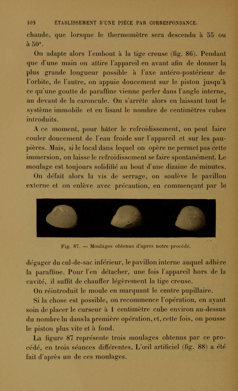 chaude, que lorsque le thermomètre sera descendu à 55 ou h 50°. On adapte alors l'embout à la tige creuse (fig. 86). Pendant que d'une main on attire l'appareil en avant afin de donner la plus grande longueur possible à l'axe antéro-postérieur de l'orbite, de l'autre, on appuie doucement sur le piston jusqu'à ce qu'une goutte de paraffine vienne perler dans l'angle interne, au devant de la caroncule. On s'arrête alors en laissant tout le système immobile et en lisant le nombre de centimètres cubes introduits. A ce moment, pour hâter le refroidissement, on peut faire couler doucement de l'eau froide sur l'appareil et sur les pau- pières. Mais, si le local dans lequel on opère ne permet pas cette immersion, on laisse le refroidissement se faire spontanément. Le moulage est toujours solidifié au bout d'une dizaine de minutes. On défait alors la vis de serrage, on soulève le pavillon externe et on enlève avec précaution, en commençant par le Fig. 87. — Moulages obtenus d'après notre procédé. dégager du cul-de-sac inférieur, le pavillon interne auquel adhère la paraffine. Pour l'en détacher, une fois l'appareil hors de la cavité, il suffit de chauffer légèrement la tige creuse. On réintroduit le moule en marquant le centre pupillaire. Si la chose est possible, on recommence l'opération, en ayant soin de placer le curseur k 1 centimètre cube environ au-dessus du nombre lu dans la première opération, et, cette fois, on pousse le piston plus vite et à fond. La figure 87 représente trois moulages obtenus par ce pro- cédé, en trois séances différentes. L'œil artificiel (fig. 88) a élé fait d'après un de ces moulages.
