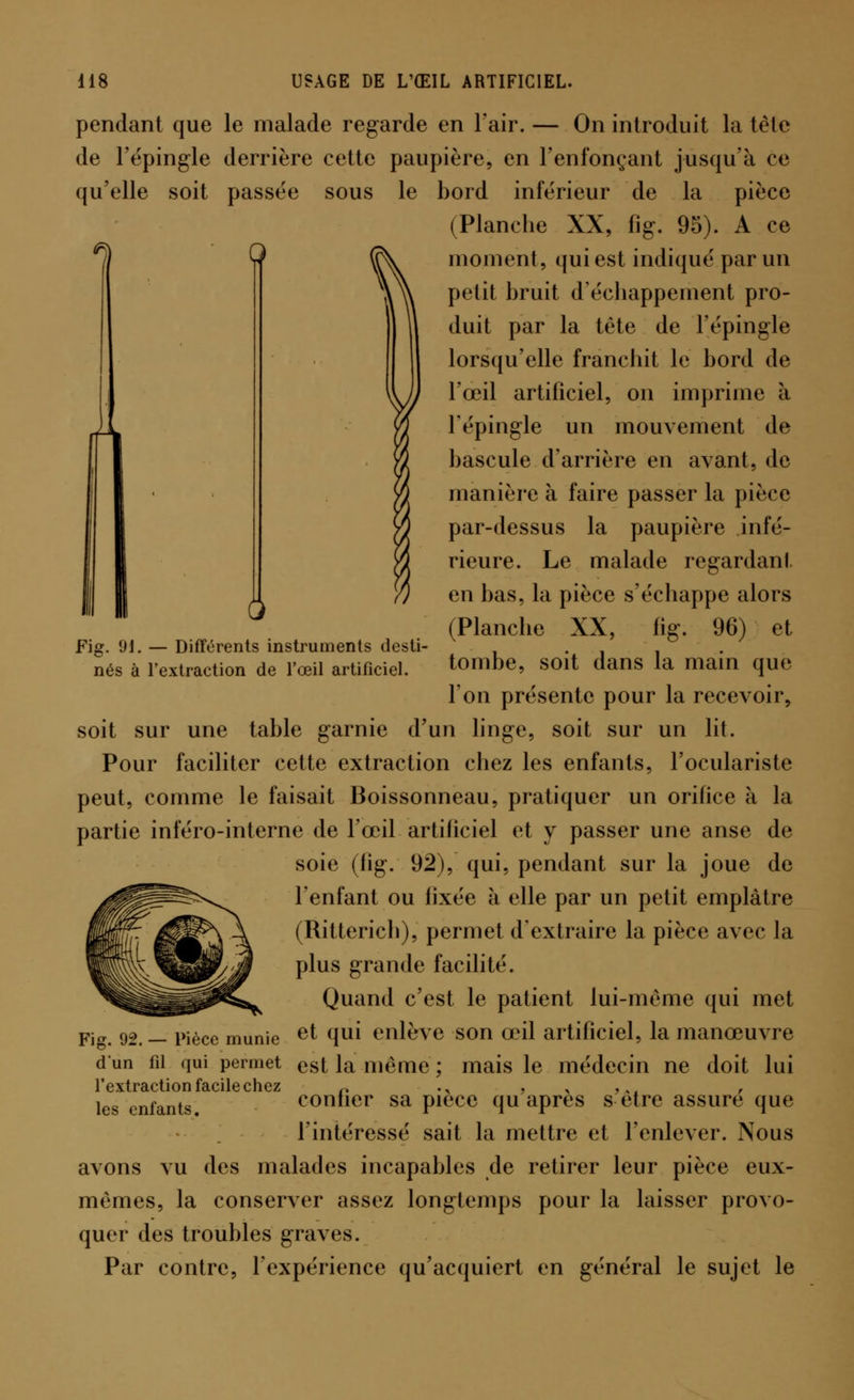 Fig. 91. — Différents instruments desti- nés à l'extraction de l'œil artificiel. pendant que le malade regarde en l'air. — On introduit la tète de l'épingle derrière cette paupière, en l'enfonçant jusqu'à ce qu'elle soit passée sous le bord inférieur de la pièce (Planche XX, fig. 95). A ce moment, qui est indiqué par un petit bruit d'échappement pro- duit par la tête de l'épingle lorsqu'elle franchit le bord de l'œil artificiel, on imprime à n l'épingle un mouvement de yî bascule d'arrière en avant, de manière à faire passer la pièce par-dessus la paupière infé- rieure. Le malade regardant en bas, la pièce s'échappe alors (Planche XX, fig. 96) et tombe, soit dans la main que l'on présente pour la recevoir, soit sur une table garnie d'un linge, soit sur un lit. Pour faciliter cette extraction chez les enfants, l'oculariste peut, comme le faisait Boissonneau, pratiquer un orifice à la partie inféro-interne de l'œil artificiel et y passer une anse de soie (iig. 92), qui, pendant sur la joue de l'enfant ou fixée à elle par un petit emplâtre (Ritterich), permet d'extraire la pièce avec la plus grande facilité. Quand c'est le patient lui-même qui met Fig. 92. — Pièce munie e^ ([U1 enlève son œil artificiel, la manœuvre dun fil qui permet est la même ; mais le médecin ne doit lui l'extraction facile chez n .y , x ,,, , les enfants. confier sa pièce qu après s être assure que l'intéressé sait la mettre et l'enlever. Nous avons vu des malades incapables de retirer leur pièce eux- mêmes, la conserver assez longtemps pour la laisser provo- quer des troubles graves. Par contre, l'expérience qu'acquiert en général le sujet le
