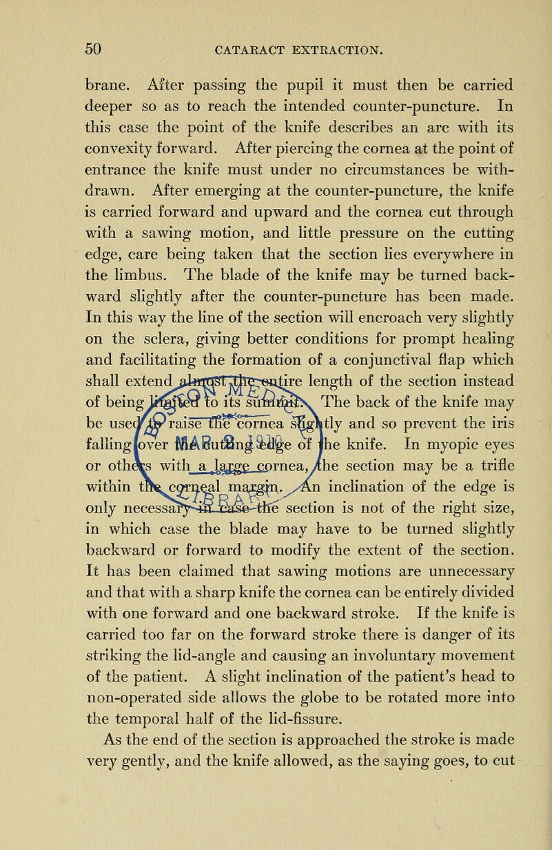 brane. After passing the pupil it must then be carried deeper so as to reach the intended counter-puncture. In this case the point of the knife describes an arc with its convexity forward. After piercing the cornea at the point of entrance the knife must under no circumstances be with- drawn. After emerging at the counter-puncture, the knife is carried forward and upward and the cornea cut through with a sawing motion, and little pressure on the cutting edge, care being taken that the section lies everywhere in the limbus. The blade of the knife may be turned back- ward slightly after the counter-puncture has been made. In this way the line of the section will encroach very slightly on the sclera, giving better conditions for prompt healing and facilitating the formation of a conjunctival flap which shall extendal*ffC£St ^hB^ea>|ire length of the section instead of being lifgireti to its sumimbv The back of the knife may be usec/iP raise tlie cornea sKgatly and so prevent the iris falling lover MABulSng^i^e of jhe knife. In myopic eyes or otheVs with a.lgjge cornea, .^he section may be a trifle within tt^corneal macgpi.^An inclination of the edge is only necessarys£-Ea£seHiie section is not of the right size, in which case the blade may have to be turned slightly backward or forward to modify the extent of the section. It has been claimed that sawing motions are unnecessary and that with a sharp knife the cornea can be entirely divided with one forward and one backward stroke. If the knife is carried too far on the forward stroke there is danger of its striking the lid-angle and causing an involuntary movement of the patient. A slight inclination of the patient's head to non-operated side allows the globe to be rotated more into the temporal half of the lid-fissure. As the end of the section is approached the stroke is made very gently, and the knife allowed, as the saying goes, to cut