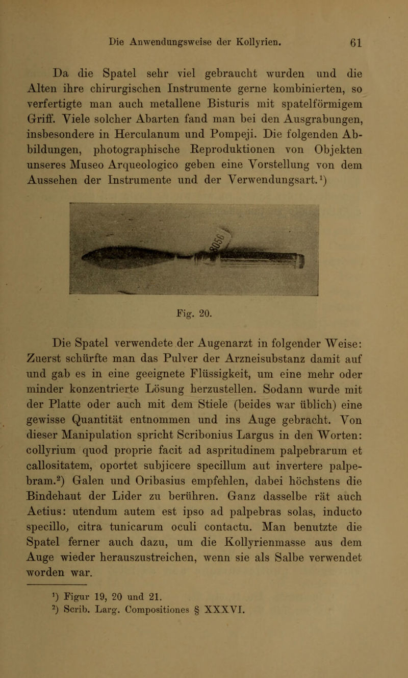 Da die Spatel sehr viel gebraucht wurden und die Alten ihre chirurgischen Instrumente gerne kombinierten, so verfertigte man auch metallene Bisturis mit spateiförmigem Griff. Viele solcher Abarten fand man bei den Ausgrabungen, insbesondere in Herculanum und Pompeji. Die folgenden Ab- bildungen, photographische Reproduktionen von Objekten unseres Museo Arqueologico geben eine Vorstellung von dem Aussehen der Instrumente und der Verwendungsart.1) Fig. 20. Die Spatel verwendete der Augenarzt in folgender Weise: Zuerst schürfte man das Pulver der Arzneisubstanz damit auf und gab es in eine geeignete Flüssigkeit, um eine mehr oder minder konzentrierte Lösung herzustellen. Sodann wurde mit der Platte oder auch mit dem Stiele (beides war üblich) eine gewisse Quantität entnommen und ins Auge gebracht. Von dieser Manipulation spricht Scribonius Largus in den Worten: collyrium quod proprie facit ad aspritudinem palpebrarum et callositatem, oportet subjicere specillum aut invertere palpe- bram.2) Galen und Oribasius empfehlen, dabei höchstens die Bindehaut der Lider zu berühren. Ganz dasselbe rät auch Aetius: utendum autem est ipso ad palpebras solas, inducto specillo, citra tunicarum oculi contactu. Man benutzte die Spatel ferner auch dazu, um die Kollyrienmasse aus dem Auge wieder herauszustreichen, wenn sie als Salbe verwendet worden war. ') Figur 19, 20 und 21. 2) Scrib. Larg. Compositiones § XXXVI.