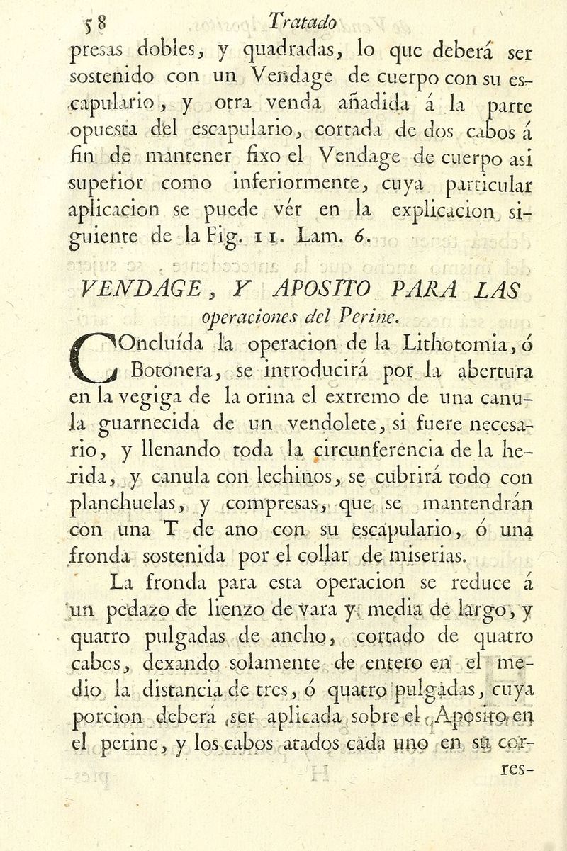 presas dobles, y quadradas, lo que deberá ser sostenido con un Vendage de cuerpo con su es- capulario , y otra venda añadida á la parte opuesta del escapulario , cortada de dos cabos á fin de mantener fixo el Vendage de cuerpo asi superior como inferiormente, cuya particular aplicación se puede ver en la explicación si- guiente de la Fig. 11. Lam. 6. ' ■ ■ ■ r$t ■ VENDAGE, Y APOSITO PARA LAS operaciones del Periné. iOncluída la operación de la Lithotomia, ó Botonera, se introducirá por la abertura en la vegiga de la orina el extremo de una cánu- la guarnecida de un vendolete, si fuere necesa- rio , y llenando toda la circunferencia de la he- xida, y cánula con lechinos,. se cubrirá todo con planchuelas, y compresas, que se mantendrán con una T de ano con su escapulario, o una fronda sostenida por el collar de miserias. La fronda para esta operación se reduce á un pedazo de lienzo de vara y; media dé largo, y quatro pulgadas de ancho, cortado de quatro cabos, dexando solamente de entero en el me- dio la distancia de tres, ó quatro pulgadas, cuya porción deberá (ser aplicada sobre el t Aposito? en el periné, y los cabos atados cada uno en s% cor- res-
