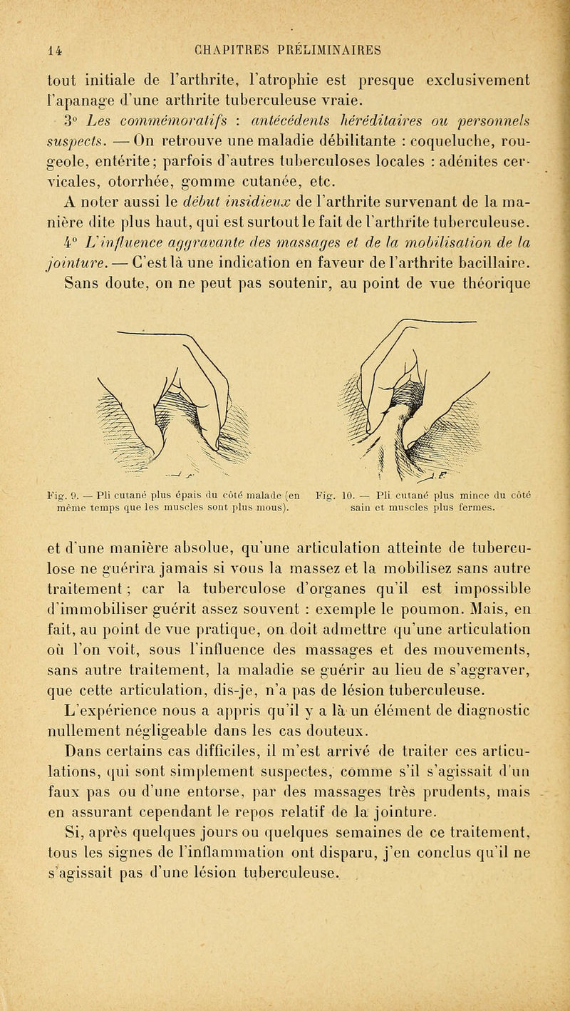 tout initiale de l'arthrite, l'atrophie est presque exclusivement l'apanage d'une arthrite tuberculeuse vraie. 3° Les commémoratifs : antécédents héréditaires ou personnels suspects. —On retrouve une maladie débilitante : coqueluche, rou- geole, entérite; parfois d'autres tuberculoses locales : adénites cer- vicales, otorrhée, gomme cutanée, etc. A noter aussi le début insidieux de l'arthrite survenant de la ma- nière dite plus haut, qui est surtout le fait de l'arthrite tuberculeuse. 4° Linfluence aggravante des massages et de la mobilisation de la jointure. — C'est là une indication en faveur de l'arthrite bacillaire. Sans doute, on ne peut pas soutenir, au point de vue théorique Kig. 9. — Pli cutané plus épais du côté malade {en Fig. 10. — Pli cutané plus mince du coté même temps que les muscles sont plus mous). sain et muscles plus fermes. et d'une manière absolue, qu'une articulation atteinte de tubercu- lose ne guérira jamais si vous la massez et la mobilisez sans autre traitement ; car la tuberculose d'organes qu'il est impossible d'immobiliser guérit assez souvent : exemple le poumon. Mais, en fait, au point de vue pratique, on doit admettre qu'une articulation où l'on voit, sous l'influence des massages et des mouvements, sans autre traitement, la maladie se guérir au lieu de s'aggraver, que cette articulation, dis-je, n'a pas de lésion tuberculeuse. L'expérience nous a appris qu'il y a là un élément de diagnostic nullement négligeable dans les cas douteux. Dans certains cas difficiles, il m'est arrivé de traiter ces articu- lations, qui sont simplement suspectes, comme s'il s'agissait d'un faux pas ou d'une entorse, par des massages très prudents, mais en assurant cependant le repos relatif de la jointure. Si, après quelques jours ou quelques semaines de ce traitement, tous les signes de l'inflammation ont disparu, j'en conclus qu'il ne s'agissait pas d'une lésion tuberculeuse.