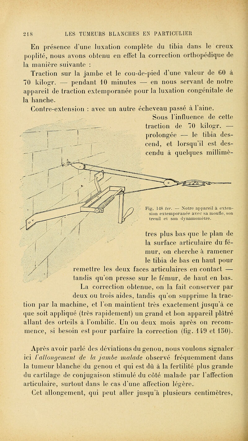 En présence d'une luxation complète du tibia dans le creux poplité, nous avons obtenu en effet la correction orthopédique de la manière suivante : Traction sur la jambe et le cou-de-pied d'une valeur de 60 à 70 kilogr. — pendant 10 minutes — en nous servant de notre appareil de traction extemporanée pour la luxation congénitale de la hanche. Contre-extension : avec un autre écheveau passé à l'aine. Sous l'influence de cette _ ,_— traction de 70 kilogr. — prolongée — le tibia des- cend, et lorsqu'il est des- cendu à quelques millimè- Fig. 148 ter. — Notre appareil à exten- sion extemporanée avec sa moufle, son treuil et son dynamomètre. très plus bas que le plan de j la surface articulaire du fé- ■ /' mur, on cherche à ramener ,,/1 le tibia de bas en haut pour : /' I remettre les deux faces articulaires en contact — WÊrfÊr' tandis qu'on presse sur le fémur, de haut en bas. La correction obtenue, on la fait conserver par deux ou trois aides, tandis qu'on supprime la trac- tion par la machine, et l'on maintient très exactement jusqu'à ce que soit appliqué (très rapidement) un grand et bon appareil plâtré allant des orteils à l'ombilic. Un ou deux mois après on recom- mence, si besoin est pour parfaire la correction {fîg. 149 et 150). Après avoir parlé des déviations du genou, nous voulons signaler ici Callongement de la jambe malade observé fréquemment dans la tumeur blanche du genou et qui est du à la fertilité plus grande du cartilage de conjugaison stimulé du côté malade par l'affection articulaire, surtout dans le cas d'une affection légère. Cet allongement, qui peut aller jusqu'à plusieurs centimètres,