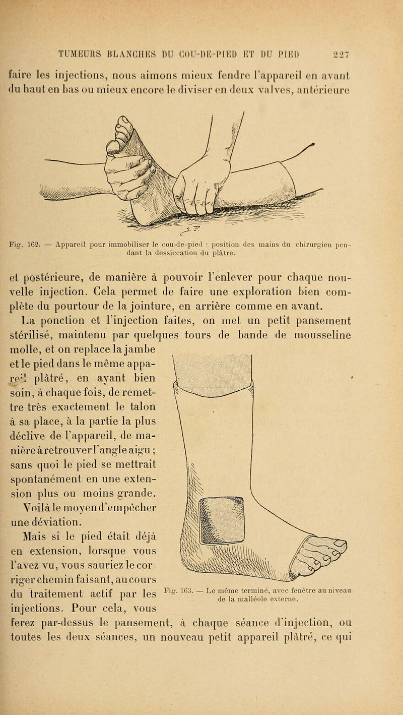 TUMEUllS 1{LANC1II<;S DU CUH-DK-PIKIJ KT DU l>IK() '.■21 faire les injections, nous aimons mieux fendre l'appareil en ;ivanl (lu haut en bas ou mieux encore le diviser en deux valves, antérieure Fig. 162. — Appareil jîour immobiliser le cou-de-pied : position des mains du chirurgien pen- dant la dessiccation du plâtre. et postérieure, de manière à pouvoir l'enlever pour chaque nou- velle injection. Cela permet de faire une exploration bien com- plète du pourtour de la jointure, en arrière comme en avant. La ponction et l'injection faites, on met un petit pansement stérilisé, maintenu par quelques tours de bande de mousseline molle, et on replace la jambe et le pied dans le même appa- reil plâtré, en ayant bien soin, à chaque fois, de remet- tre très exactement le talon à sa place, à la partie la plus déclive de l'appareil, de ma- nière àretrouverFangle aigu ; sans quoi le pied se mettrait spontanément en une exten- sion plus ou moins grande. Voilà le moyen d'empêcher une déviation. Mais si le pied était déjà en extension, lorsque vous l'avez vu, vous sauriez le cor- riger chemin faisant, au cours du traitement actif par les injections. Pour cela, vous ferez par-dessus le pansement, à chaque séance d'injection, ou toutes les deux séances, un nouveau petit appareil plâtré, ce qui 163. — Le même terminé, avec fenêtre au niveau de la malléole externe.