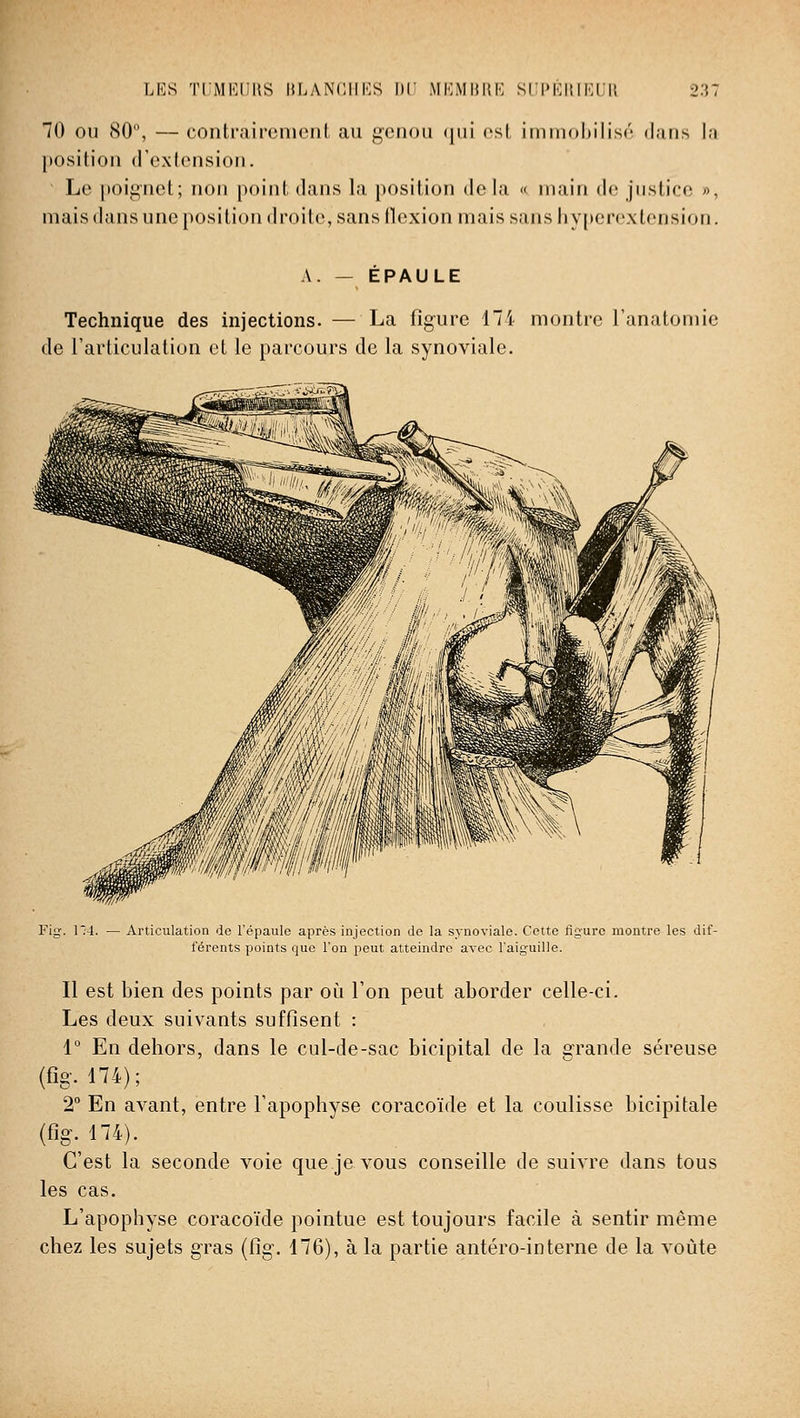 70 OU 80, — contrairement au genou (|iii csl iinmohiliso (l;iris l.i position d'extension. Le [»oignct; non point dans la position delà « main de justice », mais dans une position droite, sans (lexion mais sans hyperextension. A. — EPAULE Technique des injections. — La figure 174 montre Tanatomie de l'articulation et le parcours de la synoviale. Fig. n4. — Articulation de l'épaule après injection de la synoviale. Cette figure montre les dif- férents points que l'on peut atteindre avec l'aiguille. Il est bien des points par où l'on peut aborder celle-ci. Les deux suivants suffisent : 1 En dehors, dans le cul-de-sac bicipital de la grande séreuse (fig. 474); 2° En avant, entre l'apophyse coracoïde et la coulisse bicipitale (fig.^174). C'est la seconde voie que je vous conseille de suivre dans tous les cas. L'apophyse coracoïde pointue est toujours facile à sentir même chez les sujets gras (fig. 176), à la partie antéro-interne de la voûte