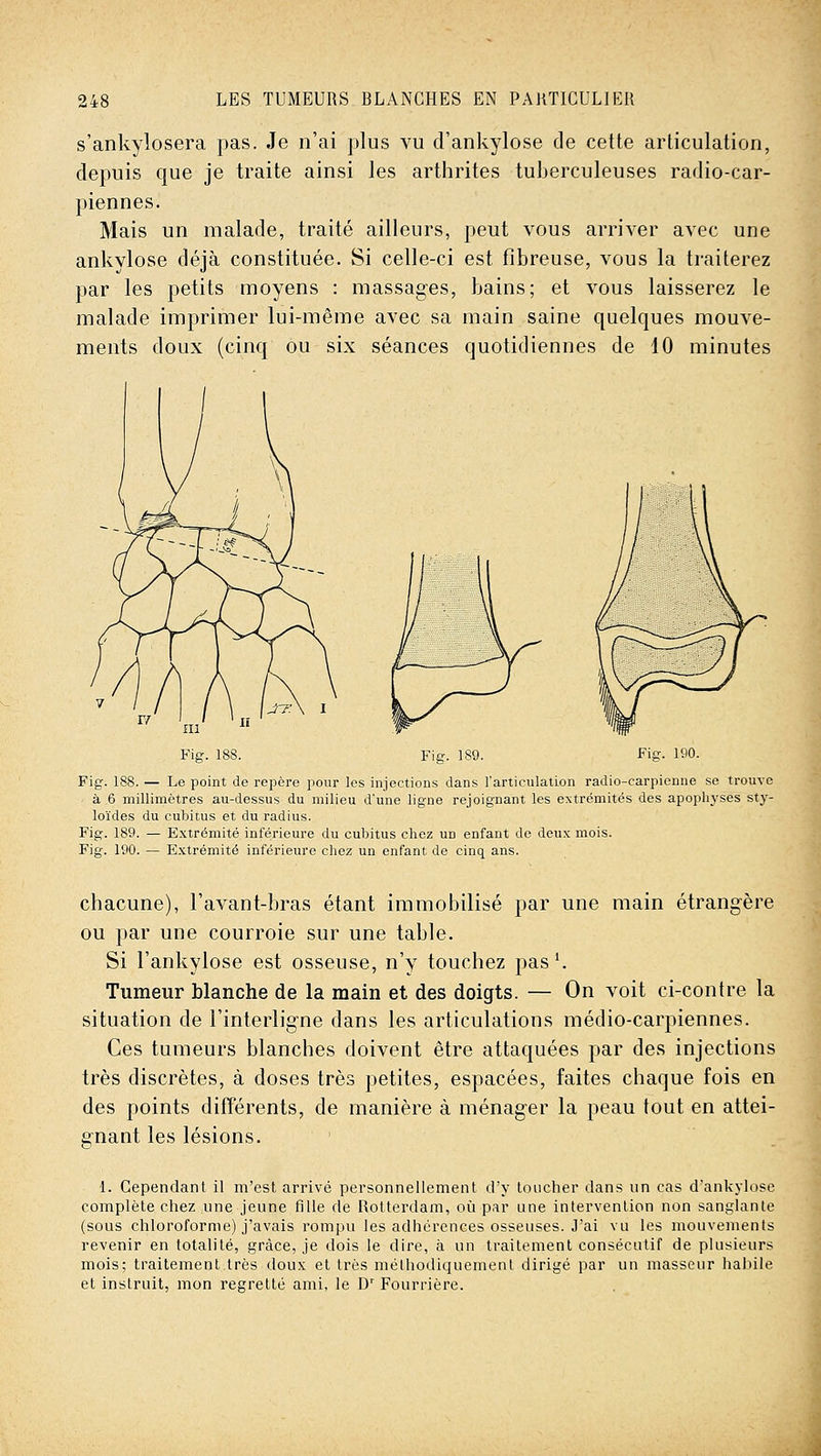 s'ankylosera pas. Je n'ai plus vu d'ankylose de cette articulation, depuis que je traite ainsi les arthrites tuberculeuses radio-car- piennes. Mais un malade, traité ailleurs, peut vous arriver avec une ankylose déjà constituée. Si celle-ci est fibreuse, vous la traiterez par les petits moyens : massages, bains; et vous laisserez le malade imprimer lui-même avec sa main saine quelques mouve- ments doux (cinq ou six séances quotidiennes de 10 minutes Fig. 188. Fig. 188. — Le point de repère pour les injections dans l'articulatLon radio-carpienne se trouve à 6 millimètres au-dessus du milieu d'une ligne rejoignant les extrémités des apophyses sty- loïdes du cubitus et du radius. Fig. 189. — Extrémité inférieure du cubitus chez un enfant de deux mois. Fig. 190. — Extrémité inférieure chez un enfant de cinq ans. chacune), Favant-bras étant immobilisé par une main étrangère ou par une courroie sur une table. Si l'ankylose est osseuse, n'y touchez pas'. Tumeur blanche de la main et des doigts. — On voit ci-contre la situation de l'interligne dans les articulations médio-carpiennes. Ces tumeurs blanches doivent être attaquées par des injections très discrètes, à doses très petites, espacées, faites chaque fois en des points différents, de manière à ménager la peau tout en attei- gnant les lésions. 1. Cependant il m'est arrivé personnellement d'y toucher dans un cas d'ankylose complète chez une jeune fille de Rotterdam, où par une intervention non sanglante (sous chloroforme) j'avais rompu les adhérences osseuses. J'ai vu les mouvements revenir en totalité, grâce, je dois le dire, à un traitement consécutif de plusieurs mois; traitement très doux et très méthodiquement dirigé par un masseur habile et instruit, mon regretté ami, le D' Fourrière.