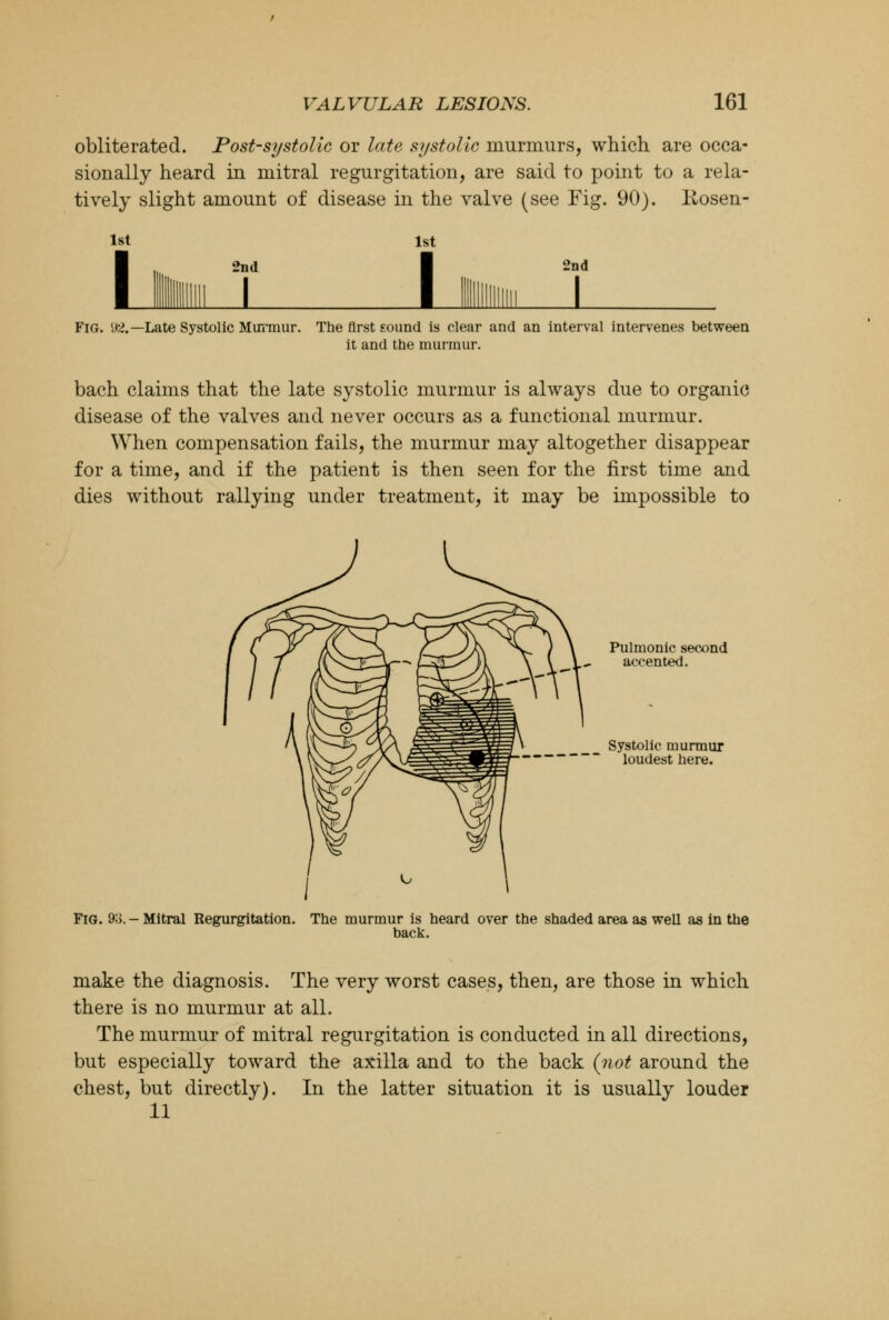 obliterated. Post-systolic or late systolic murmurs, which are occa- sionally heard in mitral regurgitation, are said to point to a rela- tively slight amount of disease in the valve (see Fig. 90). Rosen- lst L 2nd 1st 1 2nd Fig. y&— Late Systolic Murmur. The first sound is clear and an interval intervenes between it and the murmur. bach claims that the late systolic murmur is always due to organic disease of the valves and never occurs as a functional murmur. When compensation fails, the murmur may altogether disappear for a time, and if the patient is then seen for the first time and dies without rallying under treatment, it may be impossible to Pulmonic second accented. Systolic murmur loudest here. Fig. 9o. - Mitral Regurgitation. The murmur is heard over the shaded area as well as in the back. make the diagnosis. The very worst cases, then, are those in which there is no murmur at all. The murmur of mitral regurgitation is conducted in all directions, but especially toward the axilla and to the back (not around the chest, but directly). In the latter situation it is usually louder 11