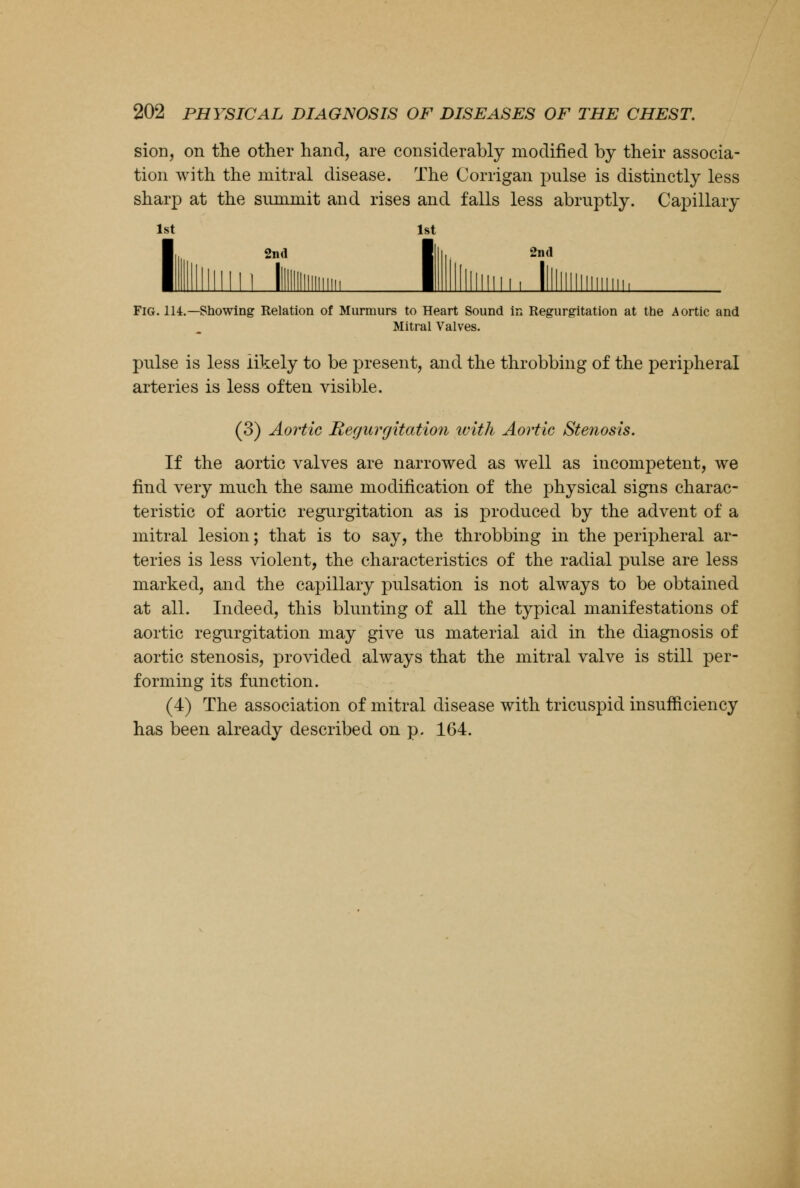 sion, on the other hand, are considerably modified by their associa- tion with the mitral disease. The Corrigan pnlse is distinctly less sharp at the summit and rises and falls less abruptly. Capillary 1st 1st I, 2nd I III 2m1 I Milium 11 Ilium! , I Fig. 114.—Showing Relation of Murmurs to Heart Sound in Regurgitation at the Aortic and Mitral Valves. pulse is less likely to be present, and the throbbing of the peripheral arteries is less often visible. (3) Aortic Regurgitation with Aortic Stenosis. If the aortic valves are narrowed as well as incompetent, we find very much the same modification of the physical signs charac- teristic of aortic regurgitation as is produced by the advent of a mitral lesion; that is to say, the throbbing in the peripheral ar- teries is less violent, the characteristics of the radial pulse are less marked, and the capillary pulsation is not always to be obtained at all. Indeed, this blunting of all the typical manifestations of aortic regurgitation may give us material aid in the diagnosis of aortic stenosis, provided always that the mitral valve is still per- forming its function. (4) The association of mitral disease with tricuspid insufficiency has been already described on p. 164.