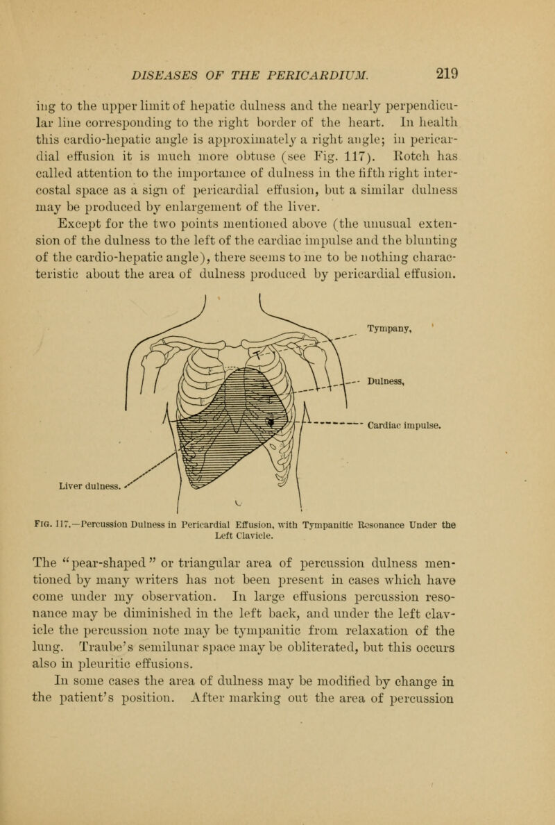 ing to the upper limit of hepatic dulness and the nearly perpendicu- lar line corresponding to the right border of the heart. In health this cardio-hepatic angle is approximately a right angle; in pericar- dial effusion it is much more obtuse (see Fig. 117). Rotch has called attention to the importance of dulness in the fifth right inter- costal space as a sign of pericardial effusion, but a similar dulness may be produced by enlargement of the liver. Except for the two points mentioned above (the unusual exten- sion of the dulness to the left of the cardiac impulse and the blunting of the cardio-hepatic angle), there seems to me to be nothing charac- teristic about the area of dulness produced by pericardial effusion. Tympany, \— Dulness, Cardiac impulse. Liver dulness. **' Fig. 117.—Percussion Dulness in Pericardial Effusion, with Tympanitic Resonance Under the Left Clavicle. The pear-shaped or triangular area of percussion dulness men- tioned by many writers has not been present in cases which have come under my observation. In large effusions percussion reso- nance may be diminished in the left back, and under the left clav- icle the percussion note may be tympanitic from relaxation of the lung. Traube's semilunar space may be obliterated, but this occurs also in pleuritic effusions. In some cases the area of dulness may be modified by change in the patient's position. After marking out the area of percussion