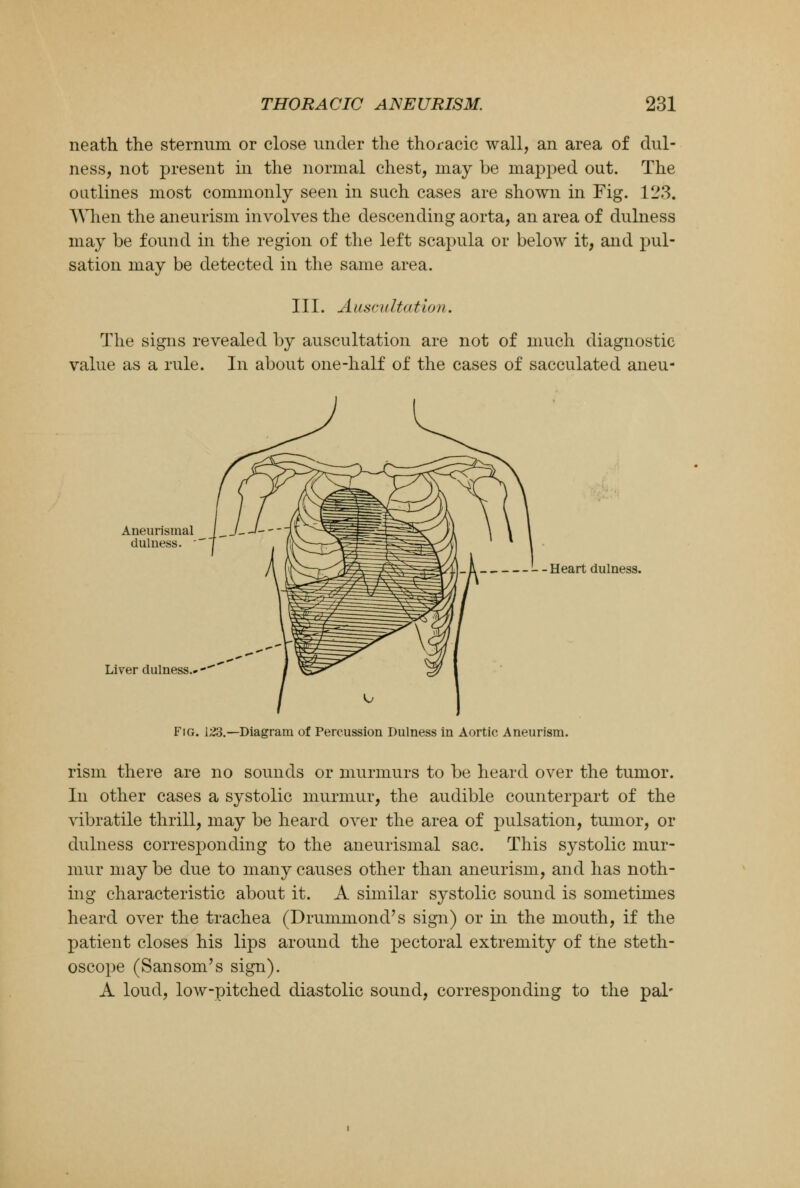 neath the sternum or close under the thoracic wall, an area of dul- ness, not present in the normal chest, may be mapped out. The outlines most commonly seen in such cases are shown in Fig. 123. When the aneurism involves the descending aorta, an area of dulness may be found in the region of the left scapula or below it, and pul- sation may be detected in the same area. III. Auscultation. The signs revealed by auscultation are not of much diagnostic value as a rule. In about one-half of the cases of sacculated aneu- Aneurisinal dulness. ' Heart dulness. Liver dulness.' I ^^^ ^ I / ^ I Fig. 123.—Diagram of Percussion Dulness in Aortic Aneurism. rism there are no sounds or murmurs to be heard over the tumor. In other cases a systolic murmur, the audible counterpart of the vibratile thrill, may be heard over the area of pulsation, tumor, or dulness corresponding to the aneurismal sac. This systolic mur- mur maybe due to many causes other than aneurism, and has noth- ing characteristic about it. A similar systolic sound is sometimes heard over the trachea (Drummond's sign) or in the mouth, if the patient closes his lips around the pectoral extremity of tne steth- oscope (Sansom's sign). A loud, low-pitched diastolic sound, corresponding to the pal-